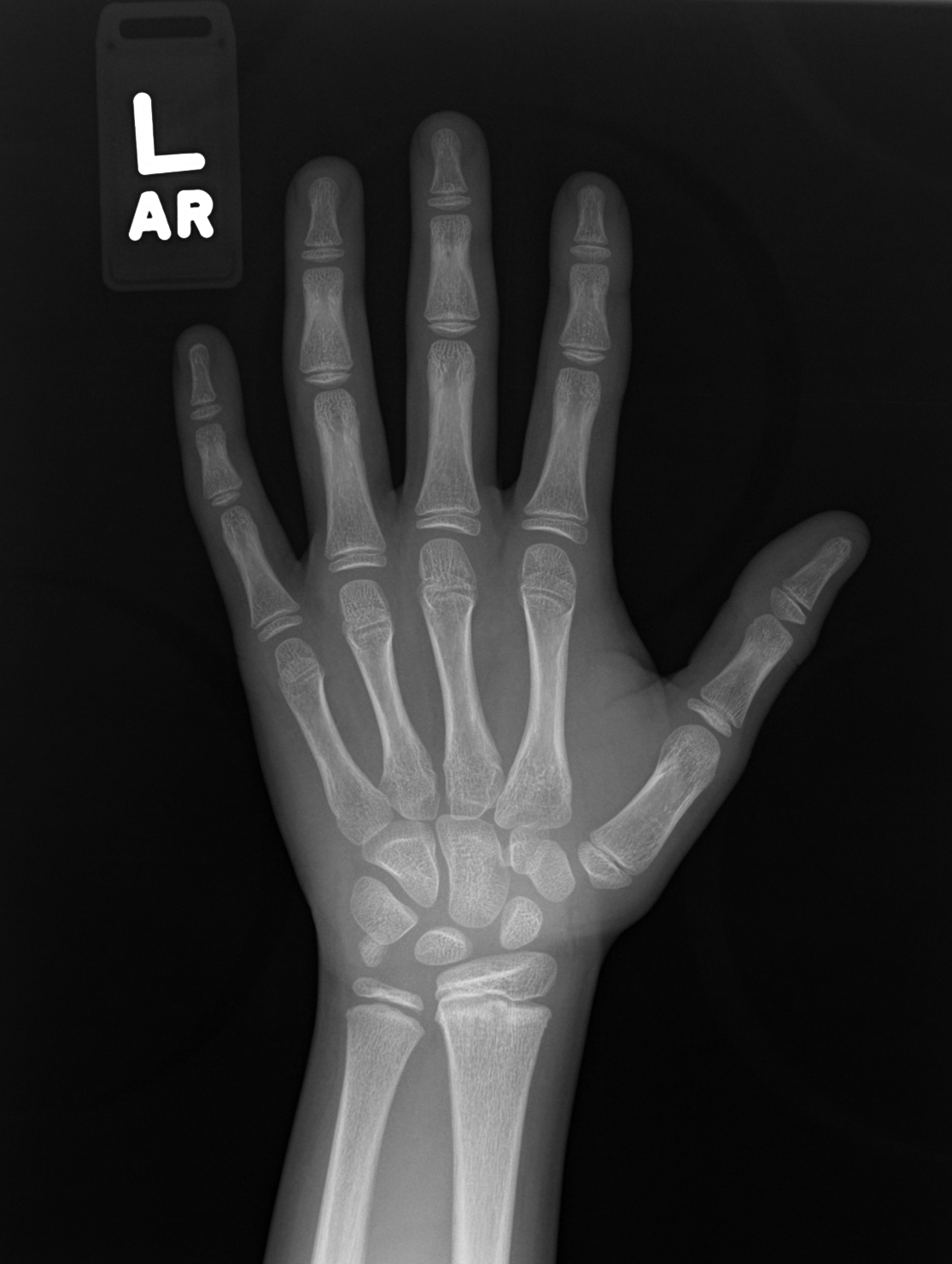 Reference image for female age 9 years 0 months