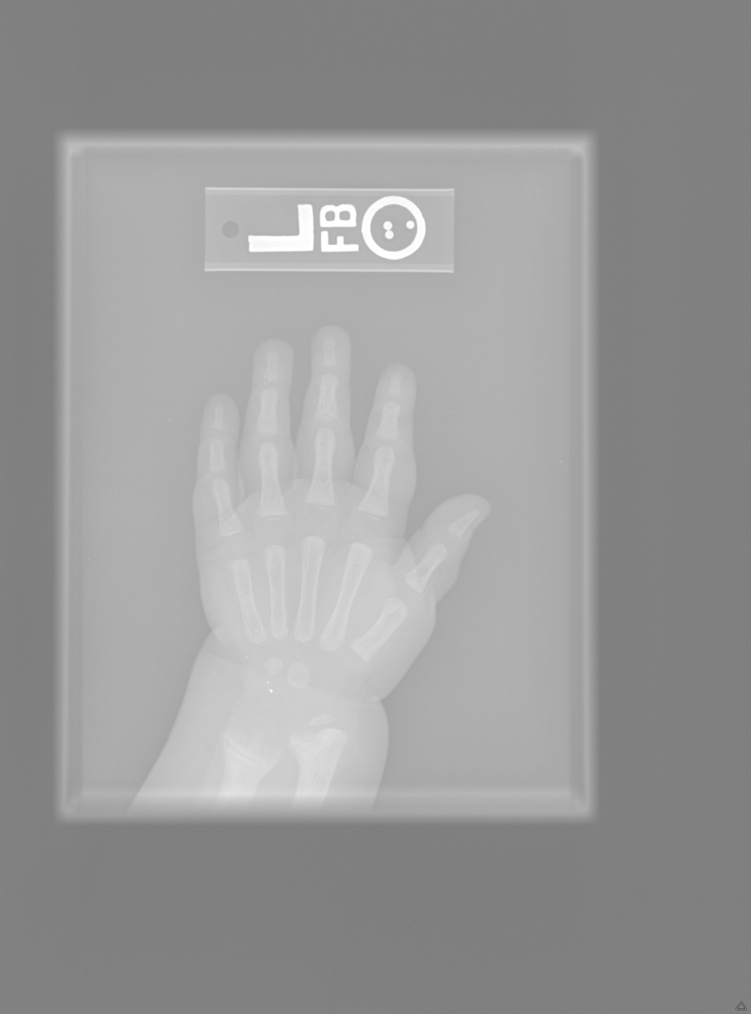 Reference image for female age 0 years 12 months