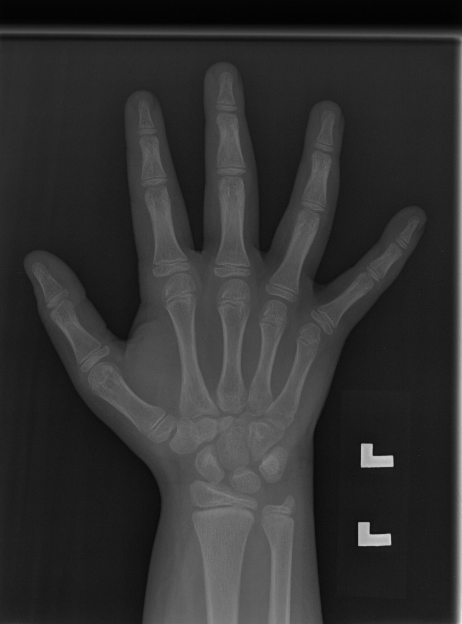 Reference image for female age 10 years 0 months