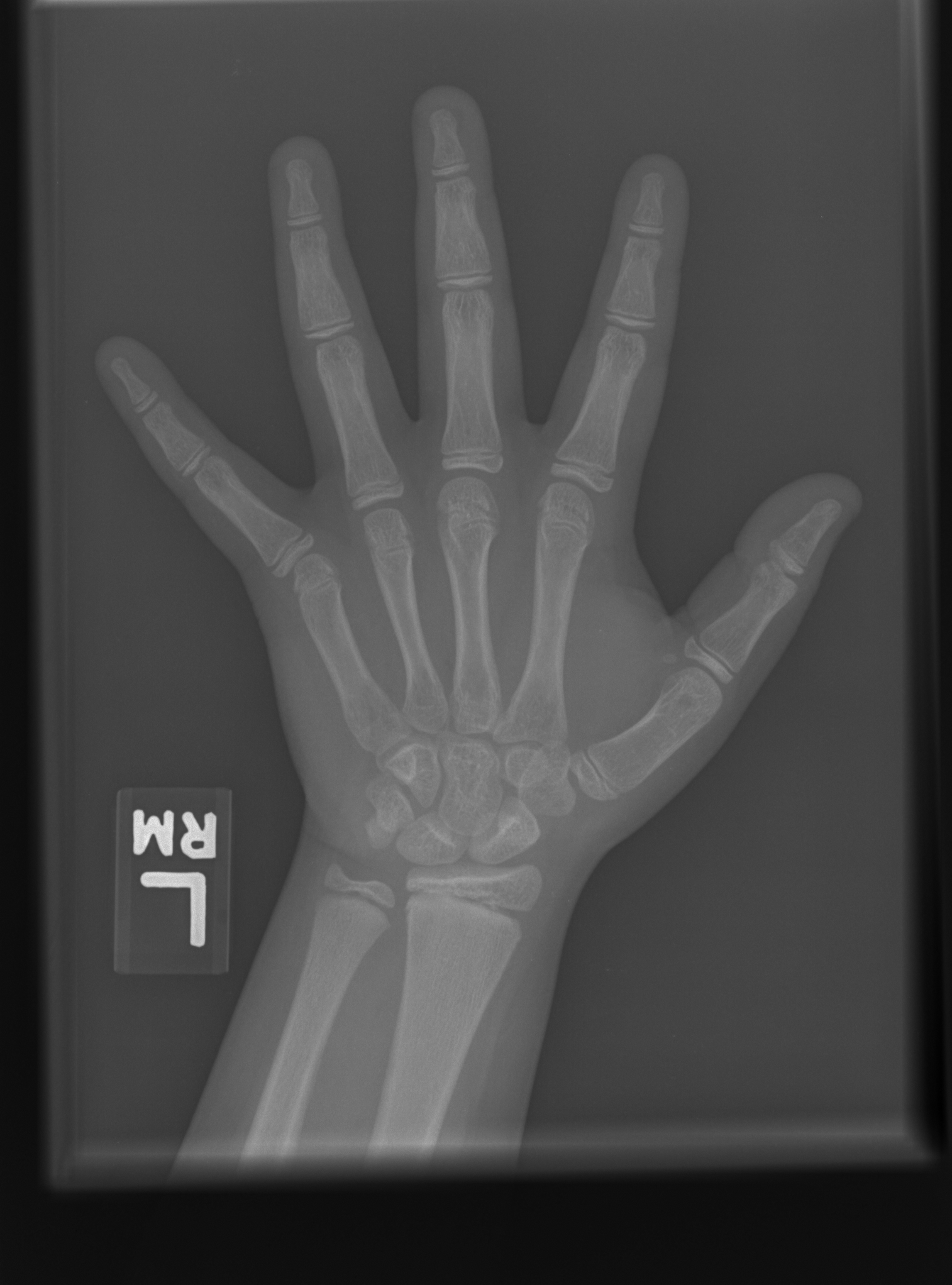 Reference image for female age 11 years 0 months