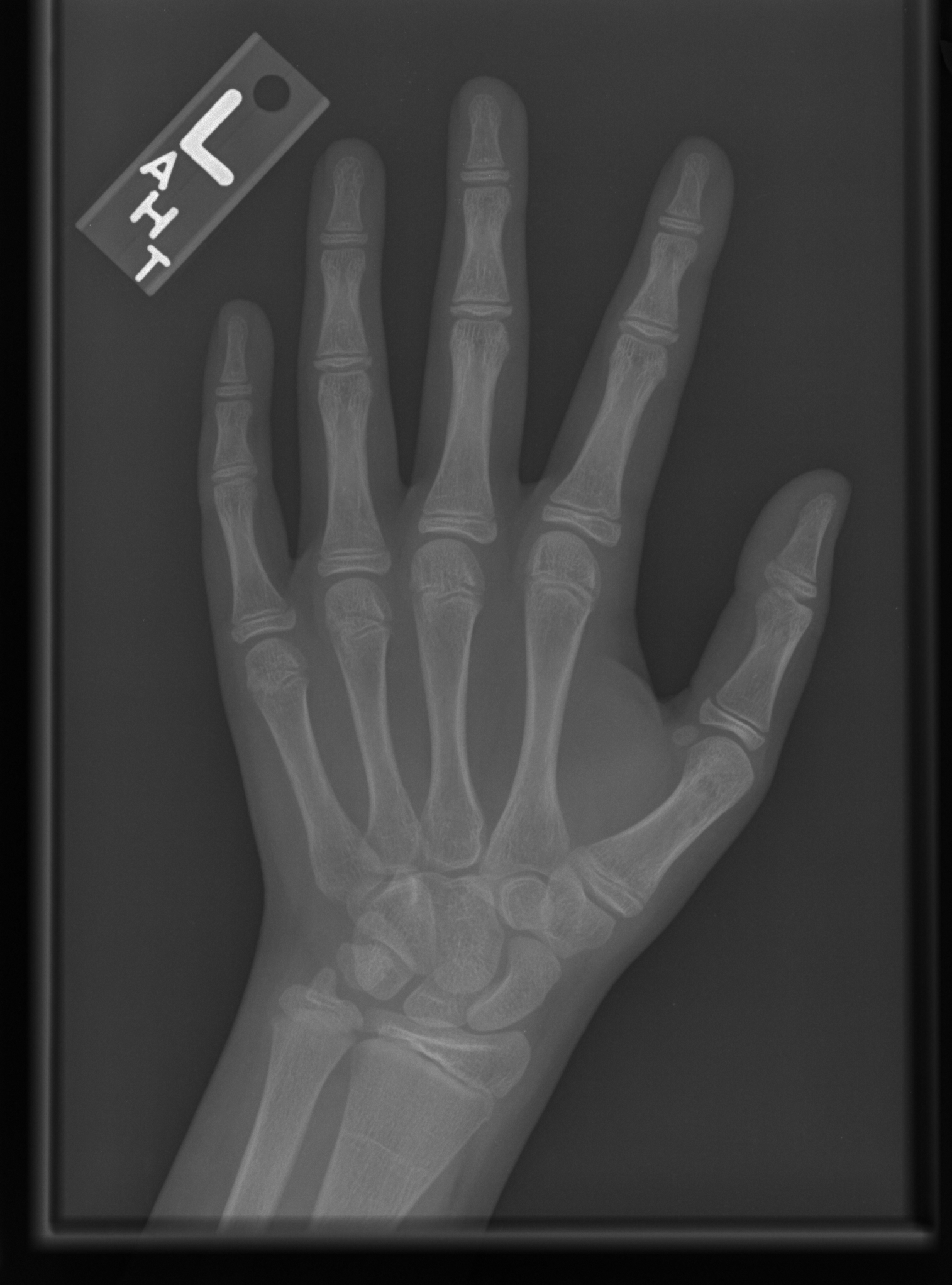 Reference image for female age 12 years 0 months