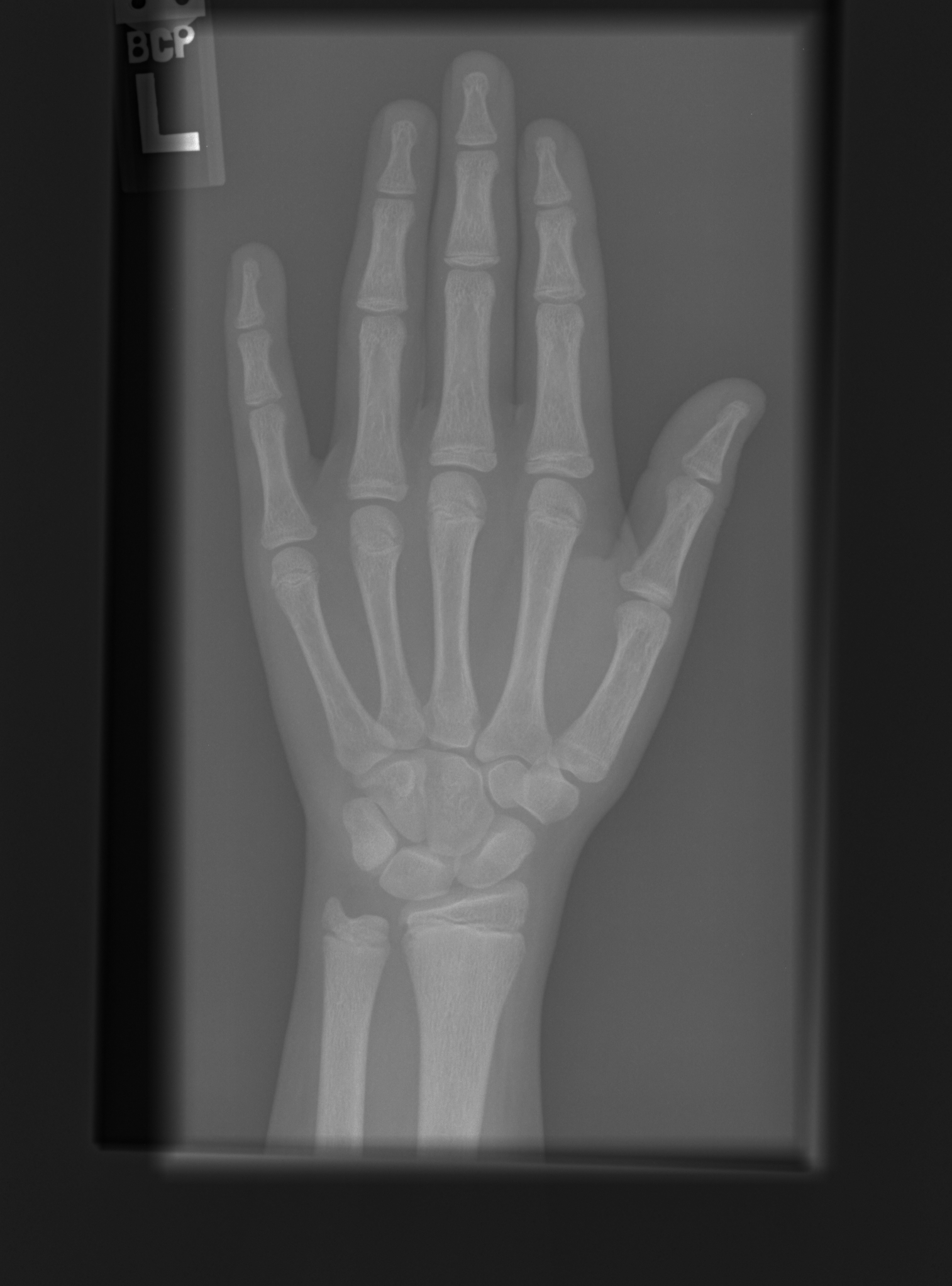 Reference image for female age 13 years 0 months