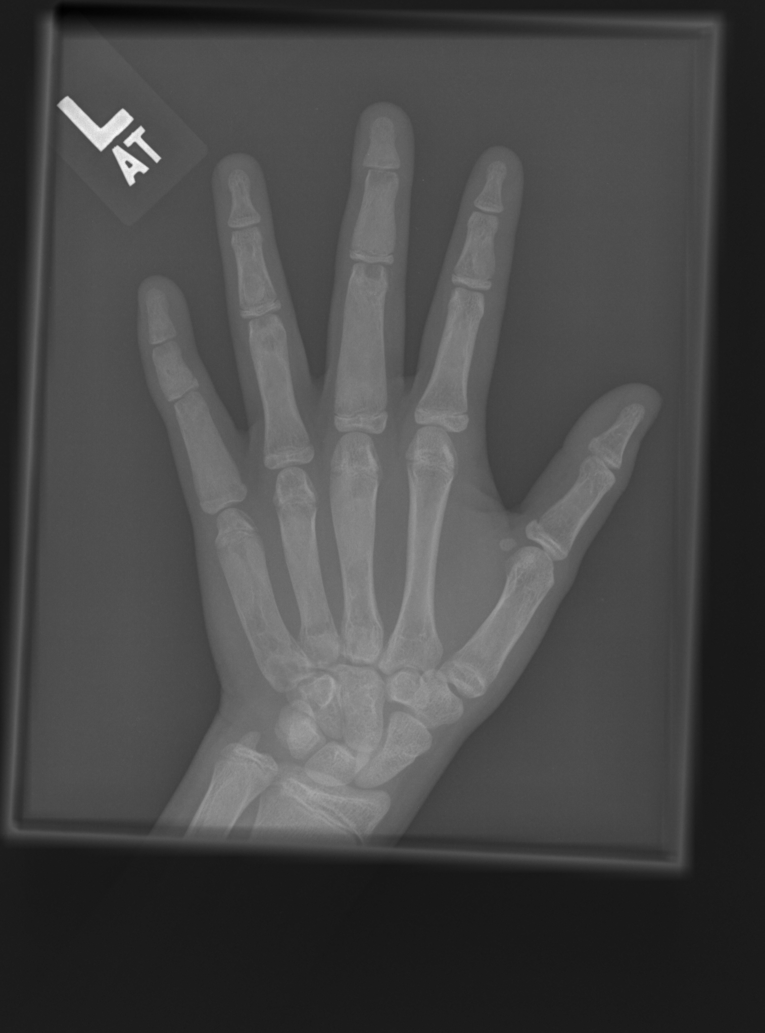 Reference image for female age 14 years 0 months