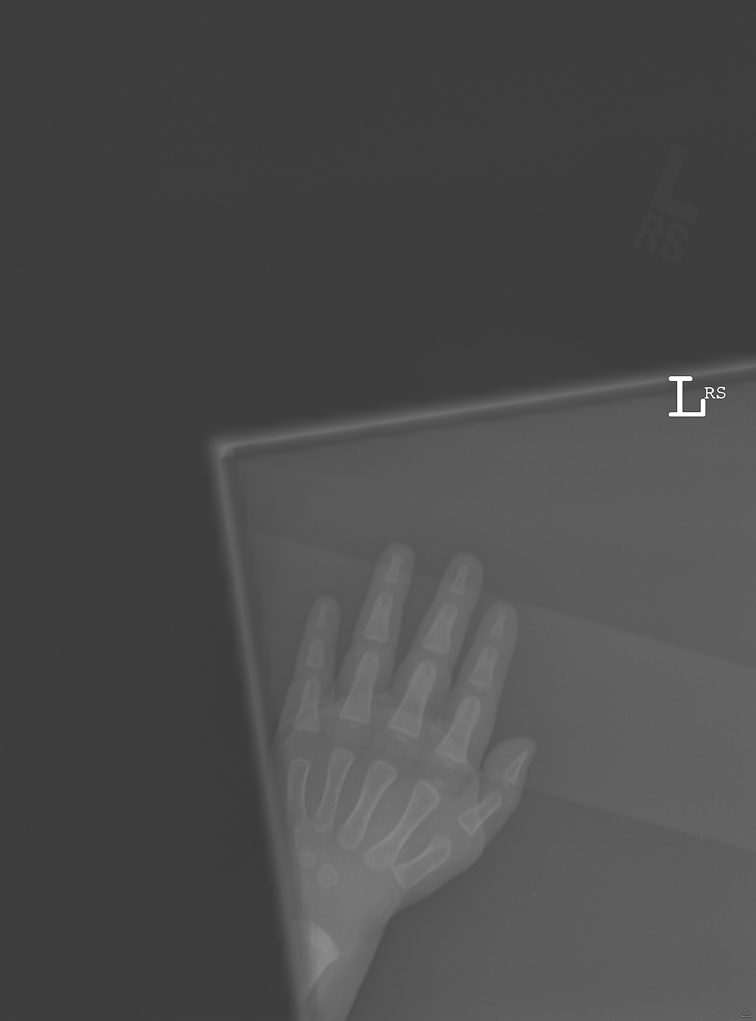 Reference image for female age 1 year 6 months