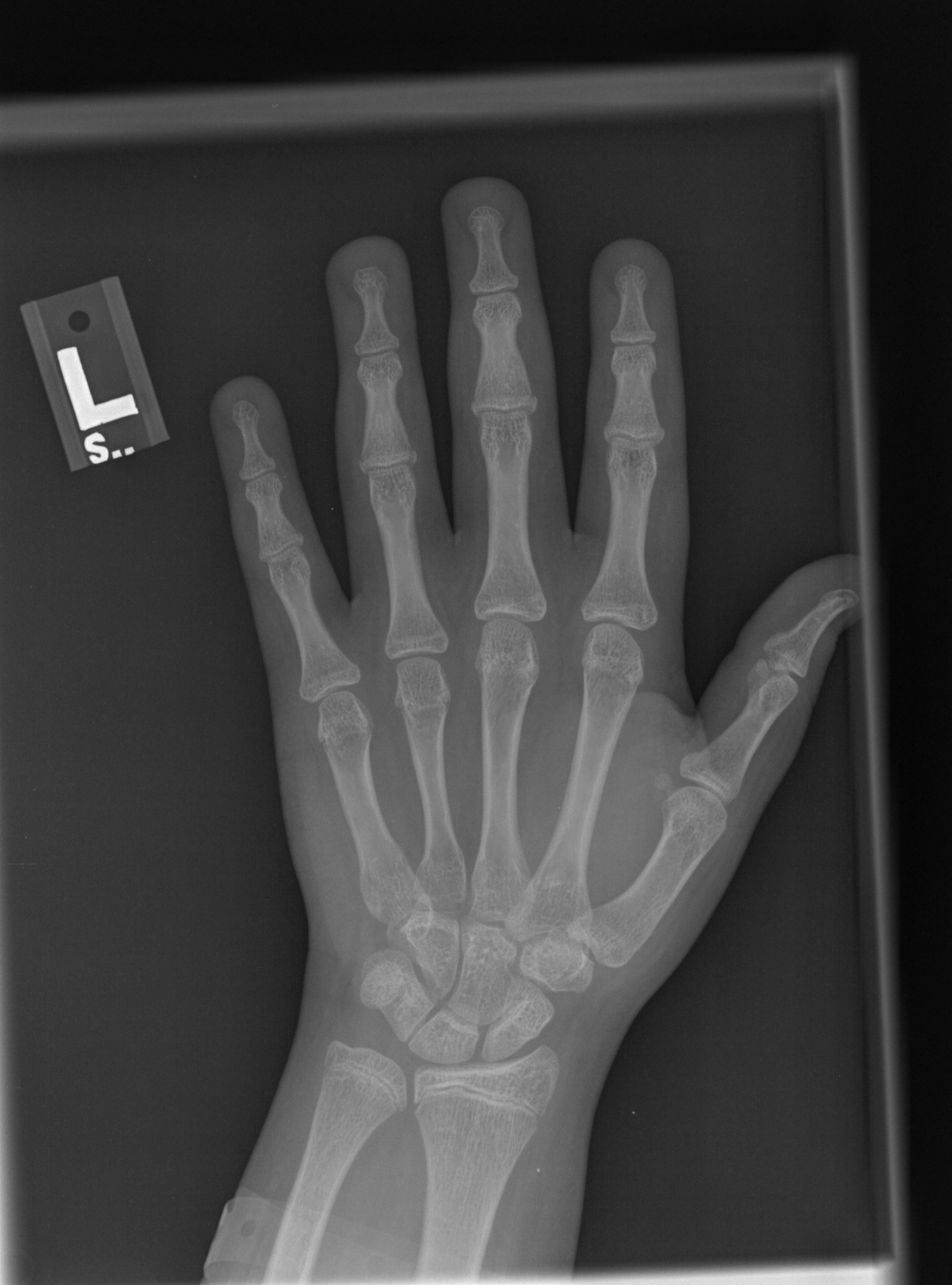 Reference image for female age 15 years 0 months