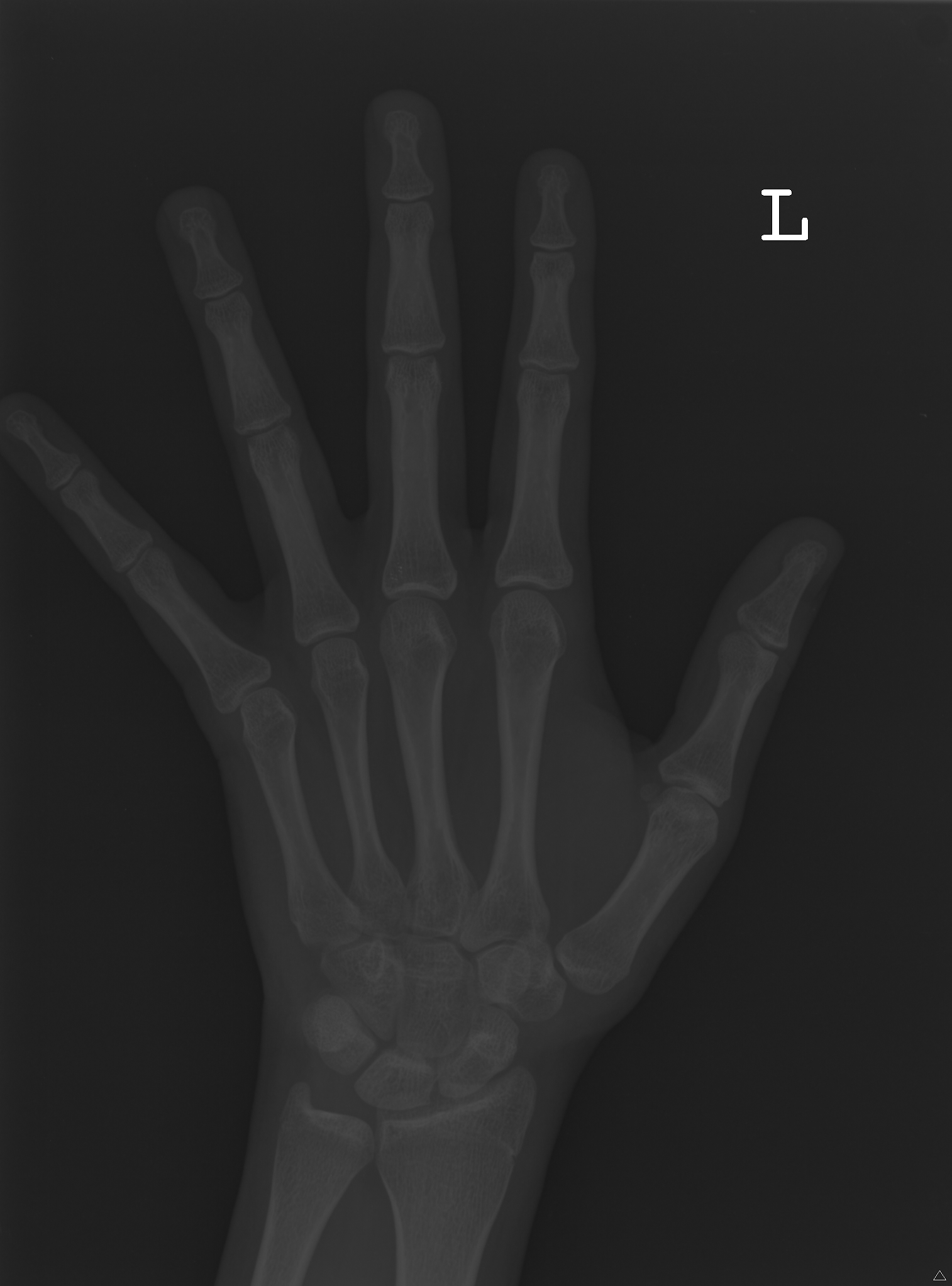 Reference image for female age 16 years 0 months