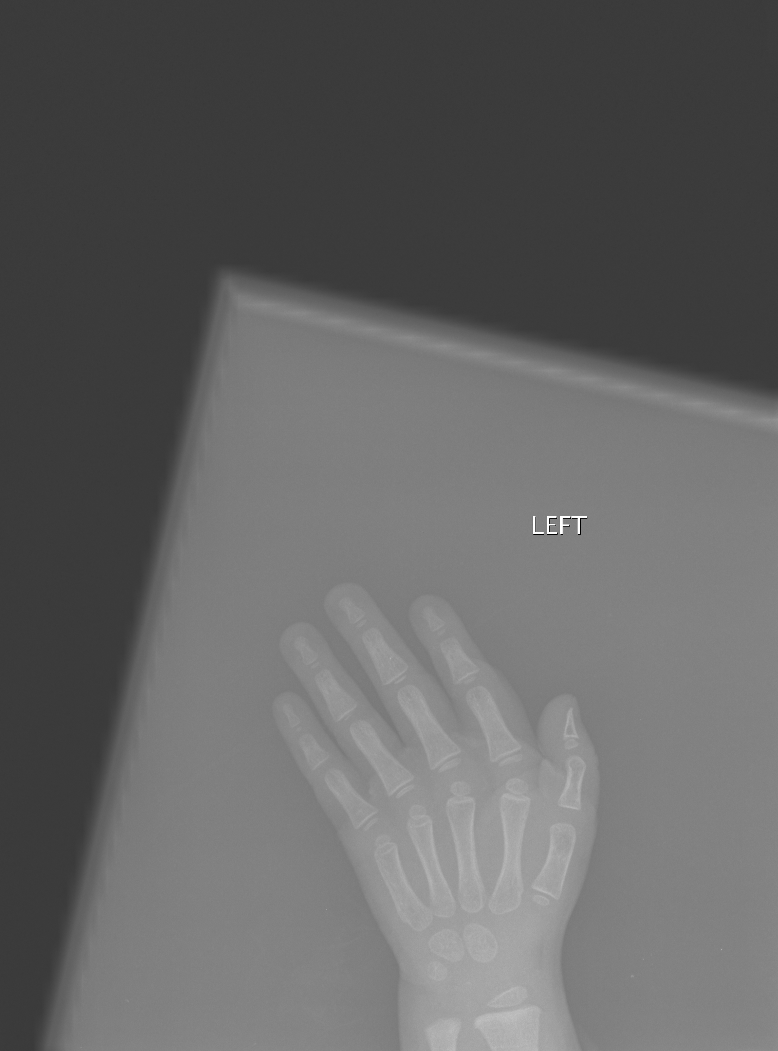 Reference image for female age 2 years 0 months