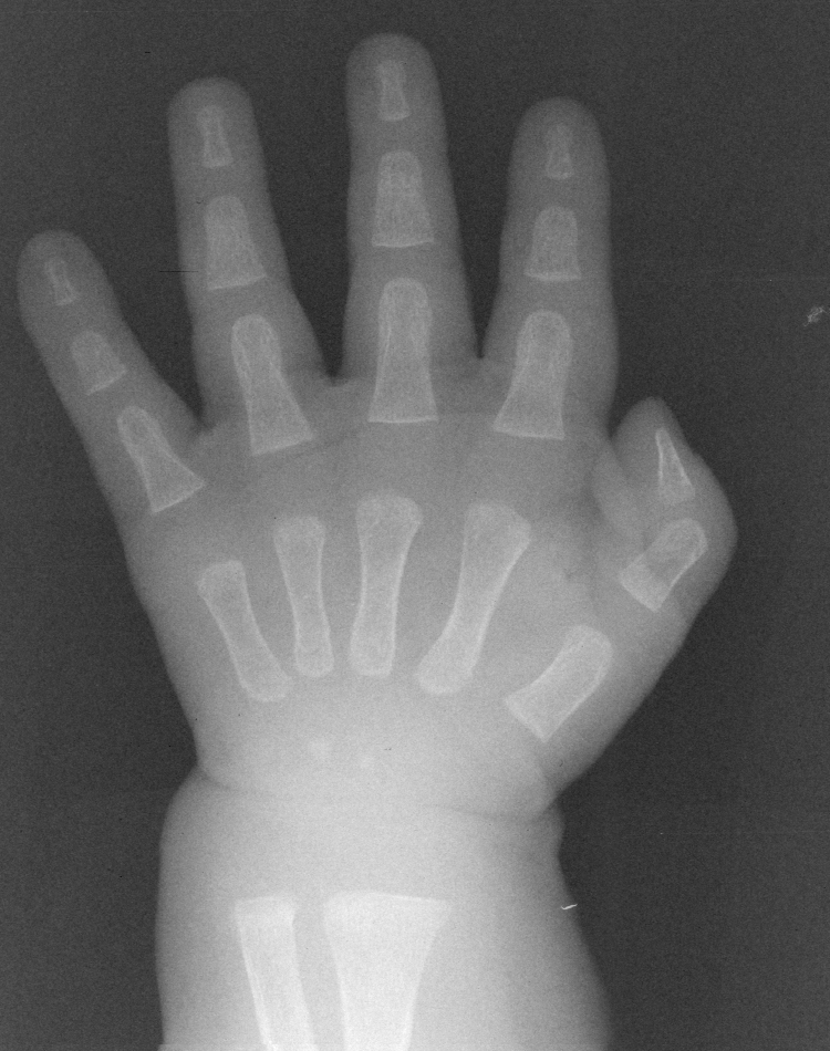 Reference image for female age 0 years 3 months