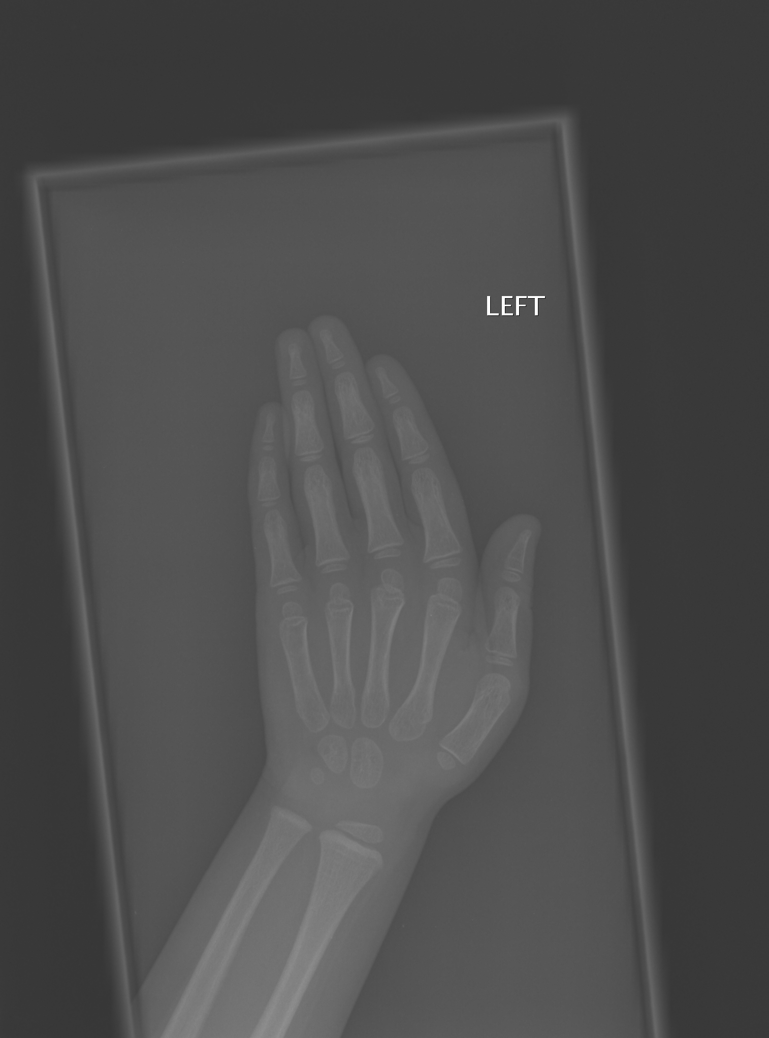 Reference image for female age 2 years 6 months