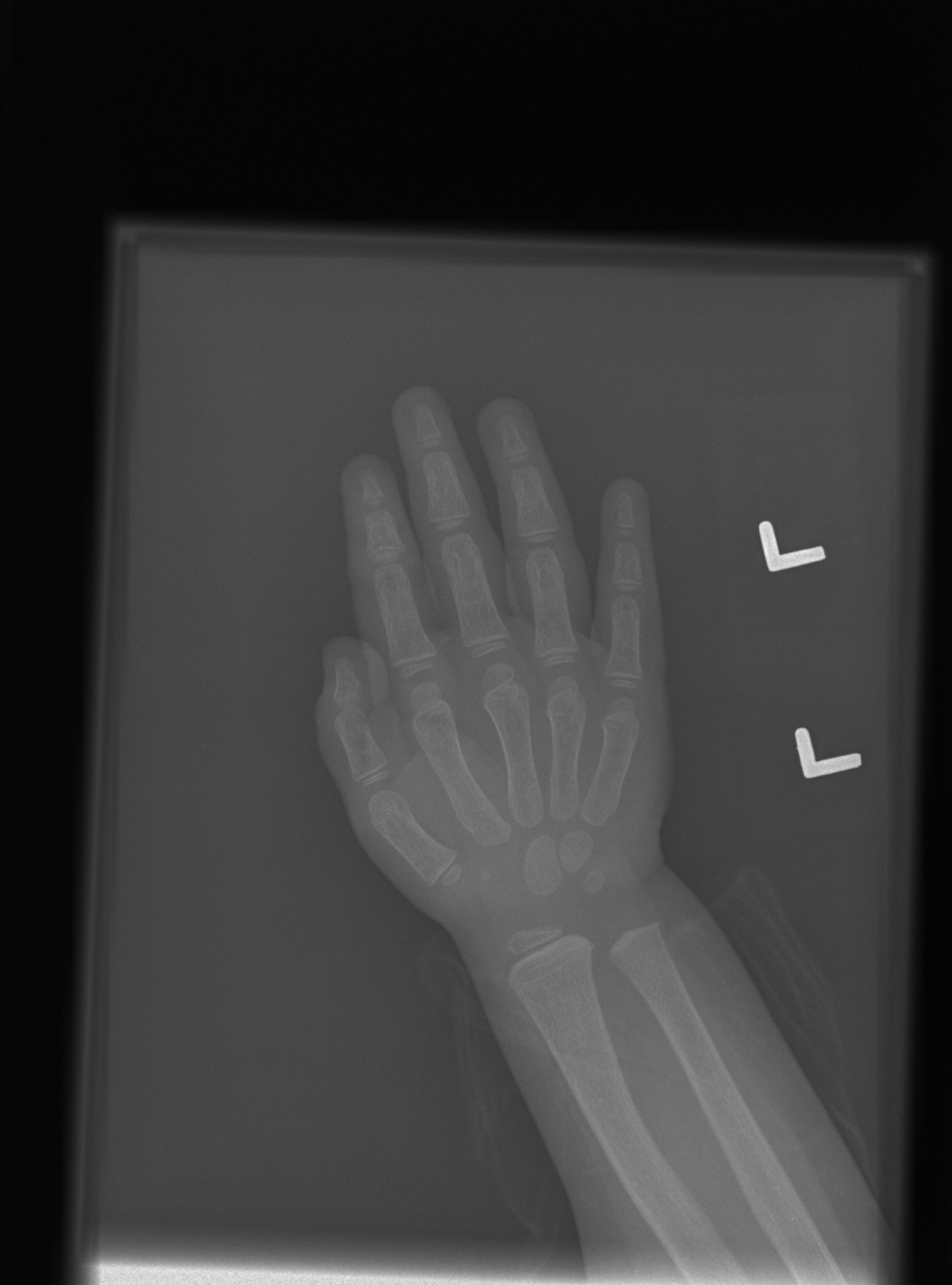 Reference image for female age 3 years 0 months