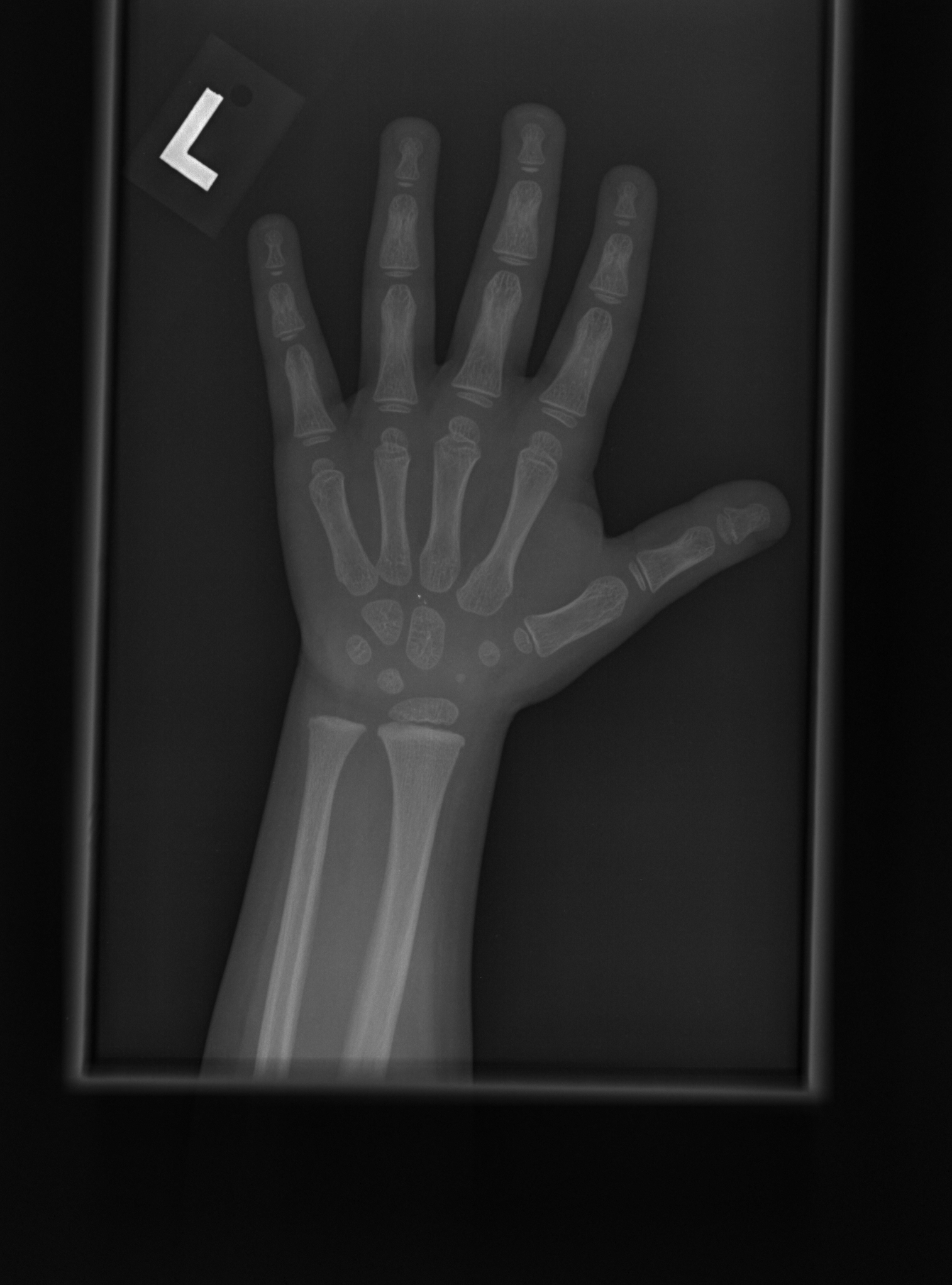 Reference image for female age 3 years 6 months