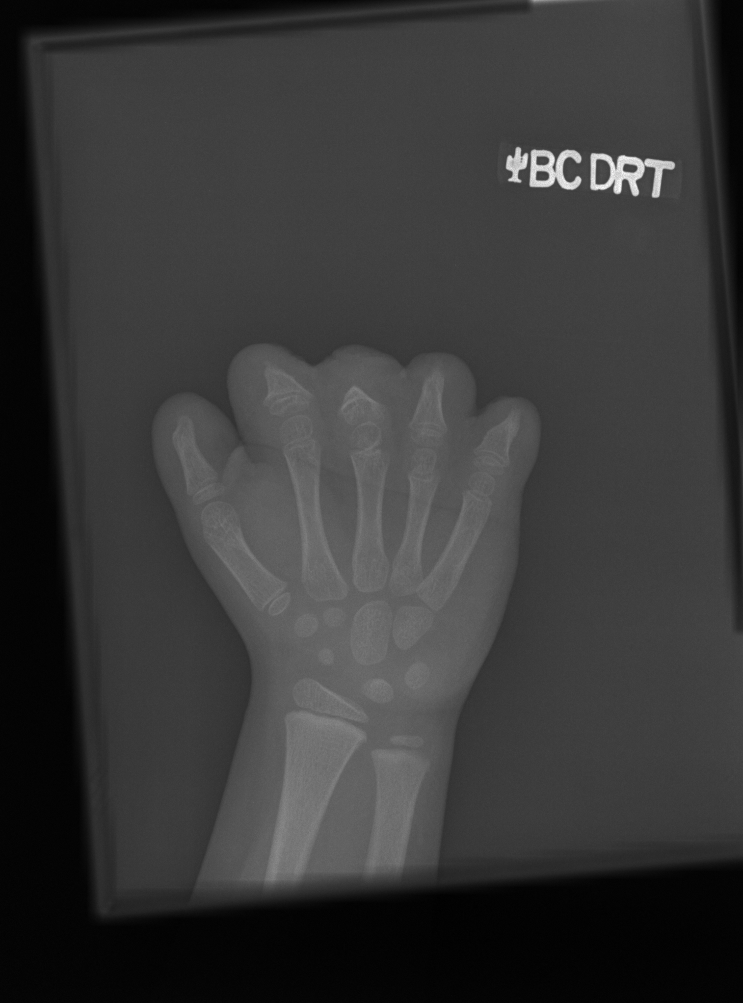 Reference image for female age 4 years 6 months