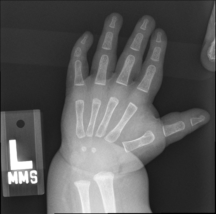 Reference image for female age 0 years 6 months