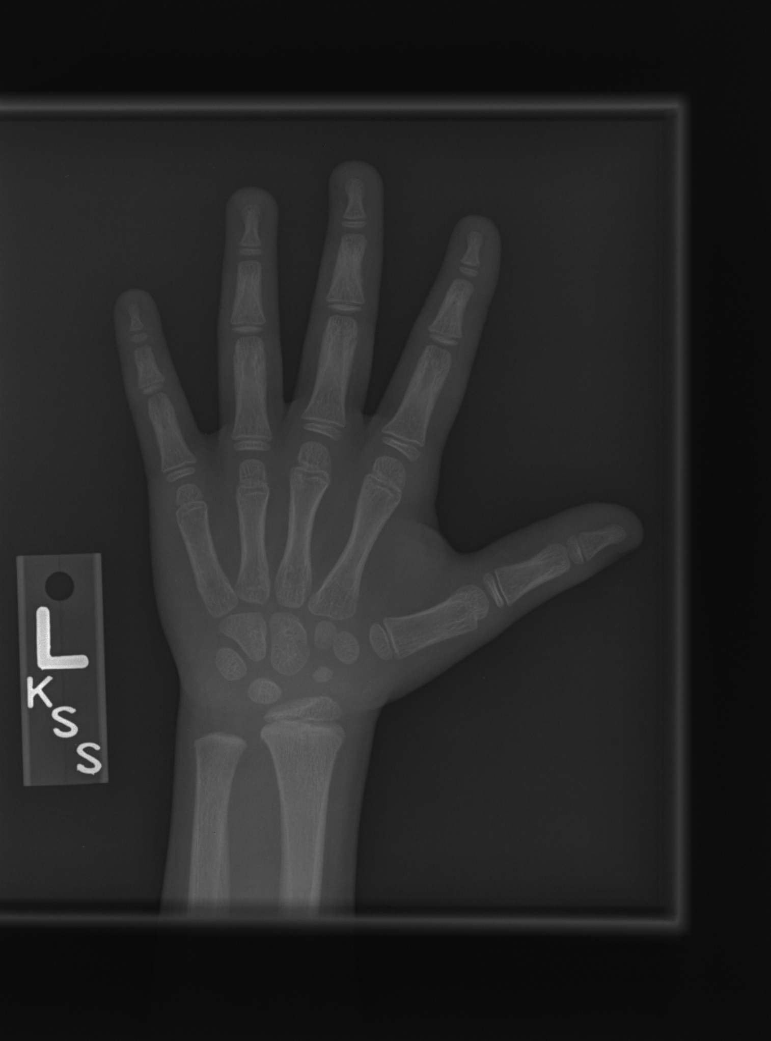 Reference image for female age 5 years 0 months