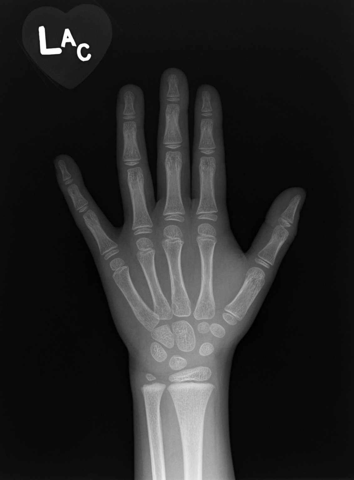 Reference image for female age 6 years 0 months