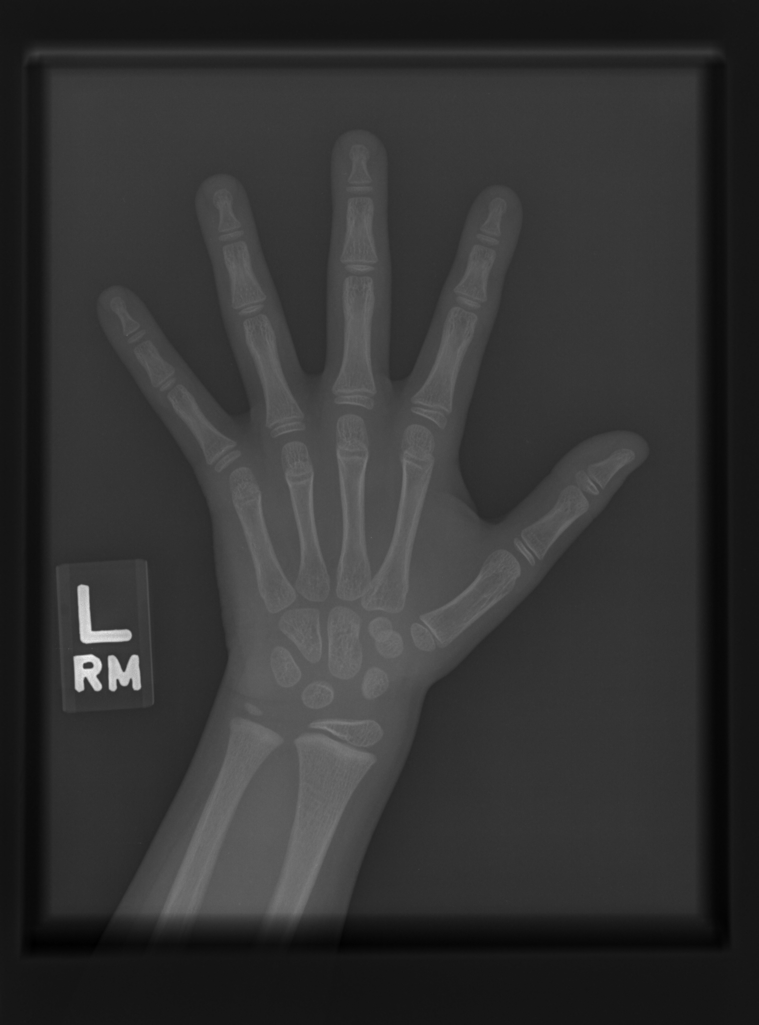 Reference image for female age 7 years 0 months