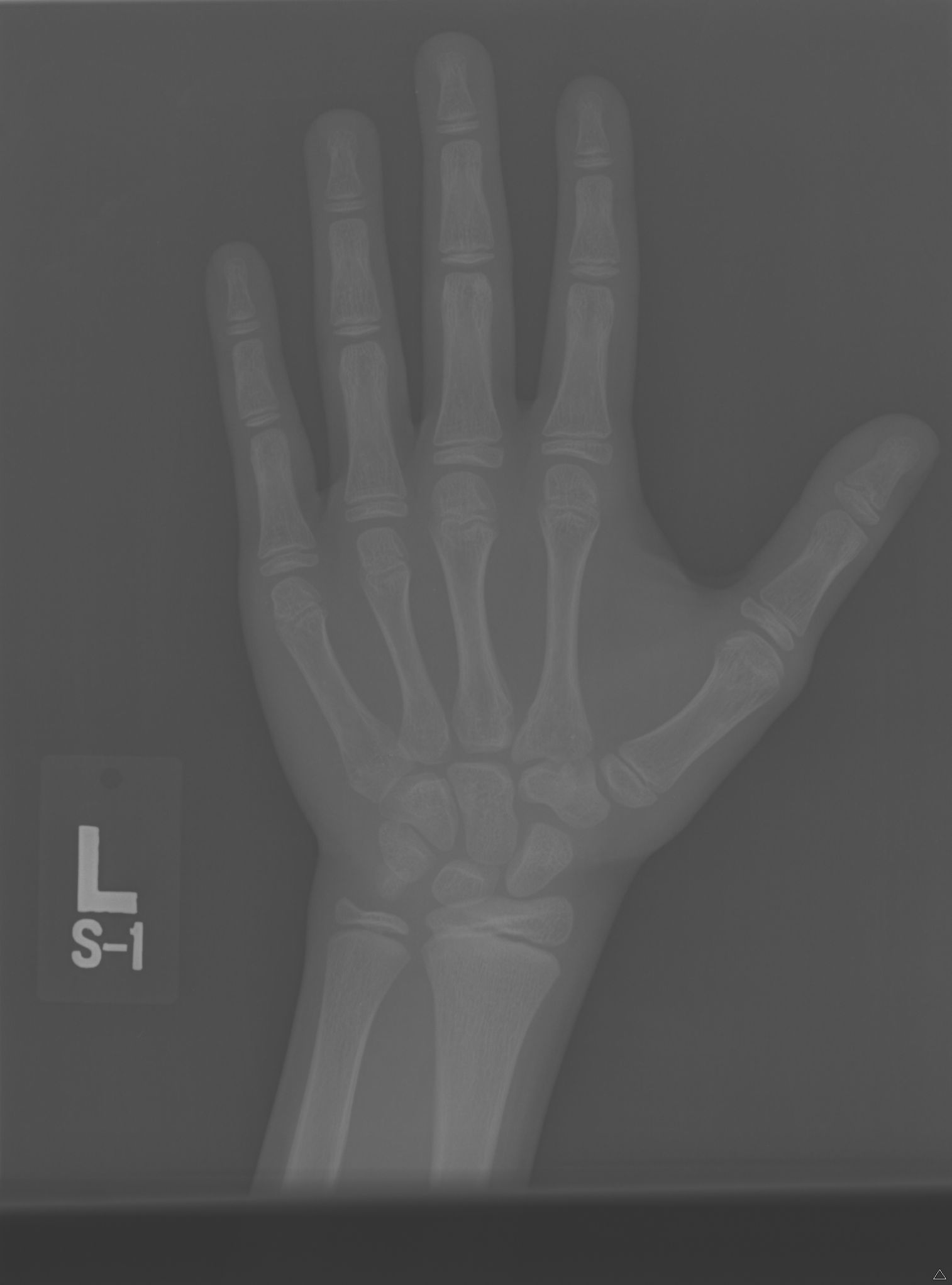 Reference image for female age 0 years 9 months