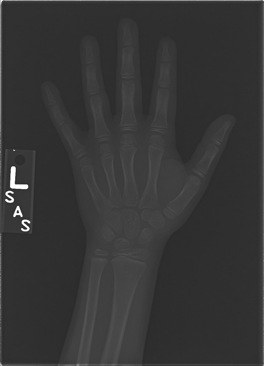 Reference image for female age 8 years 0 months