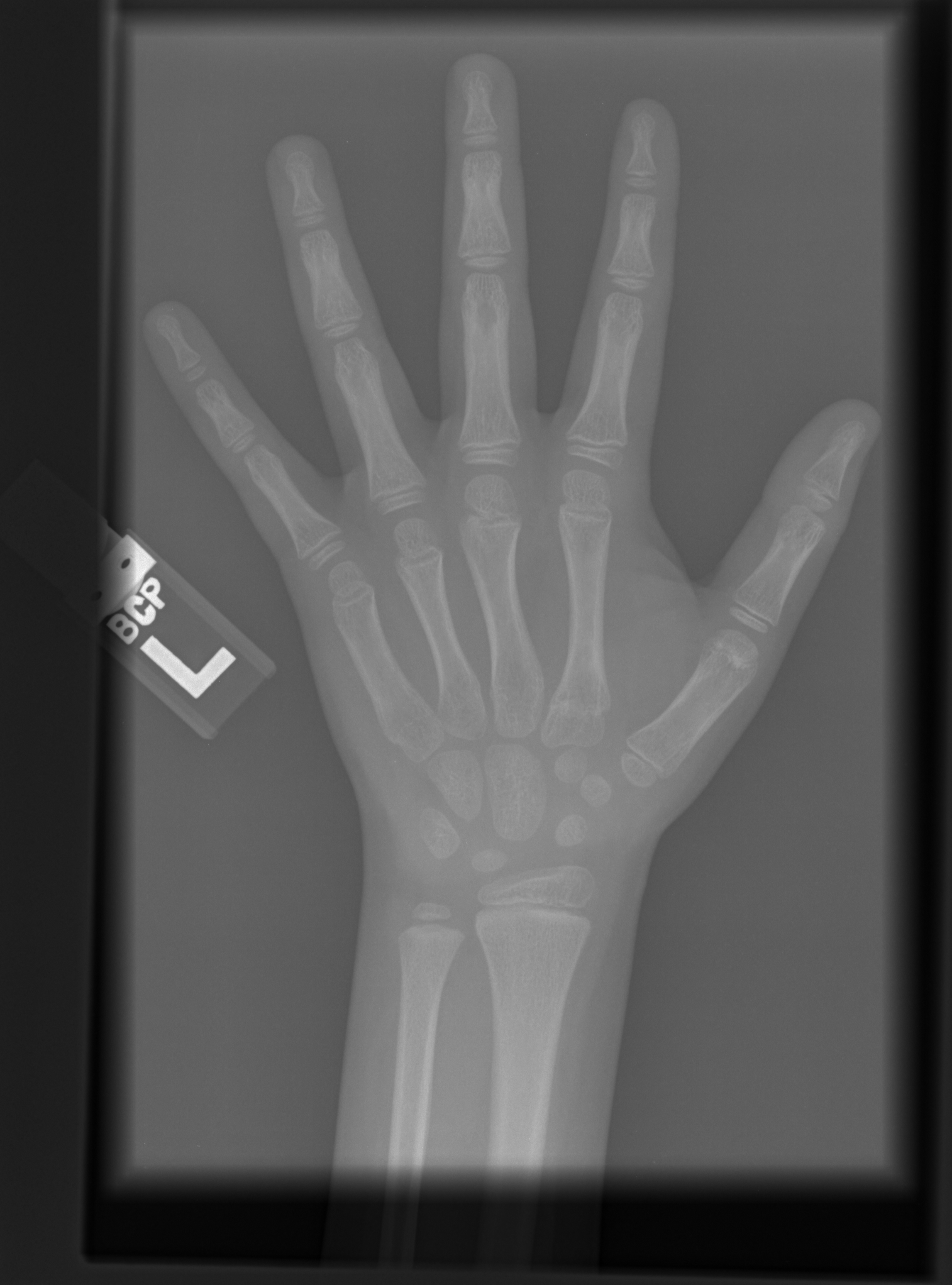 Reference image for male age 9 years 0 months