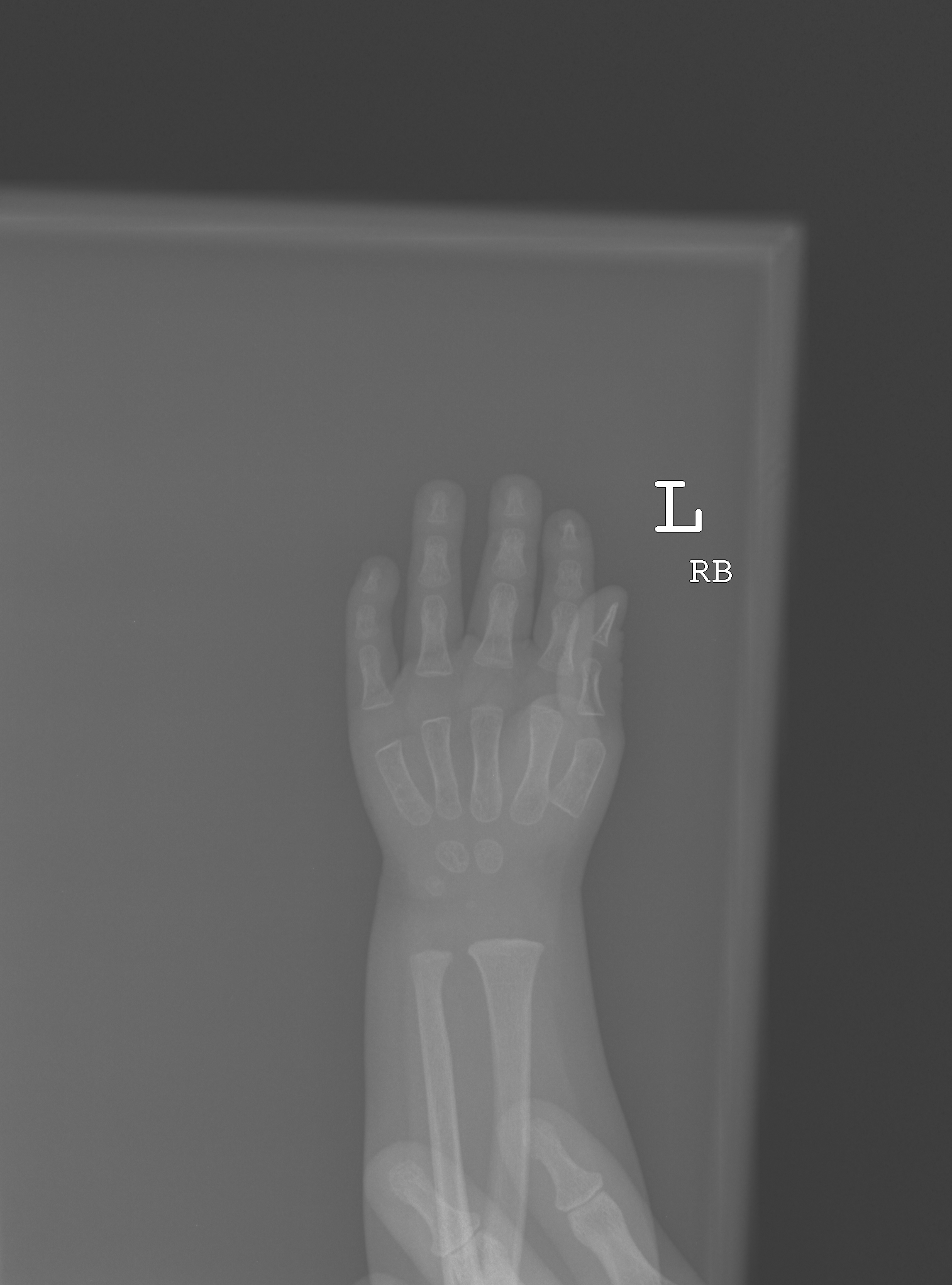 Reference image for male age 0 years 12 months