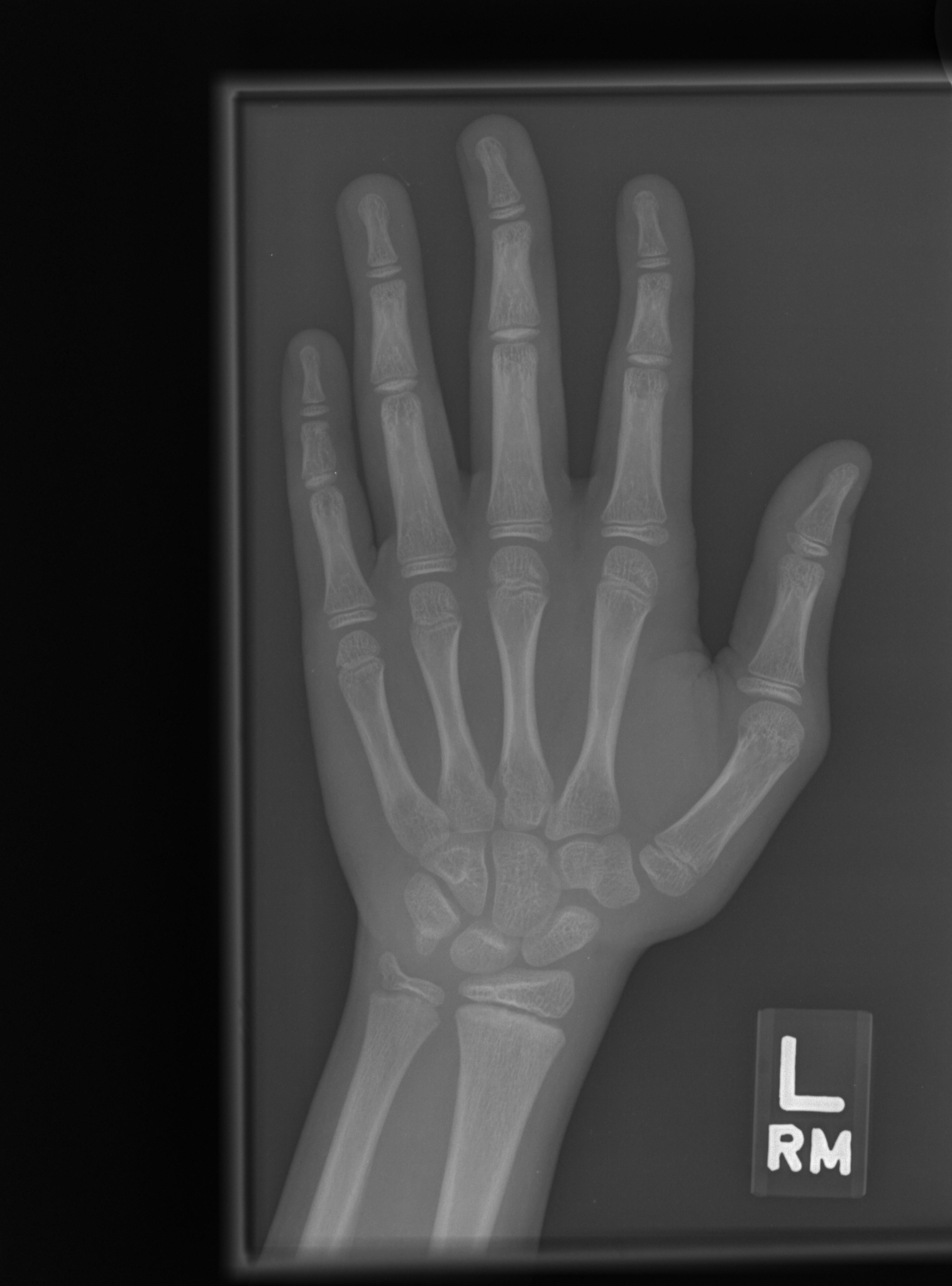 Reference image for male age 10 years 0 months