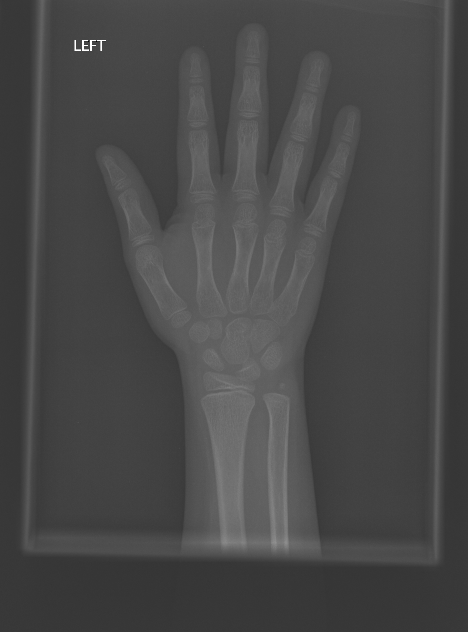 Reference image for male age 11 years 0 months