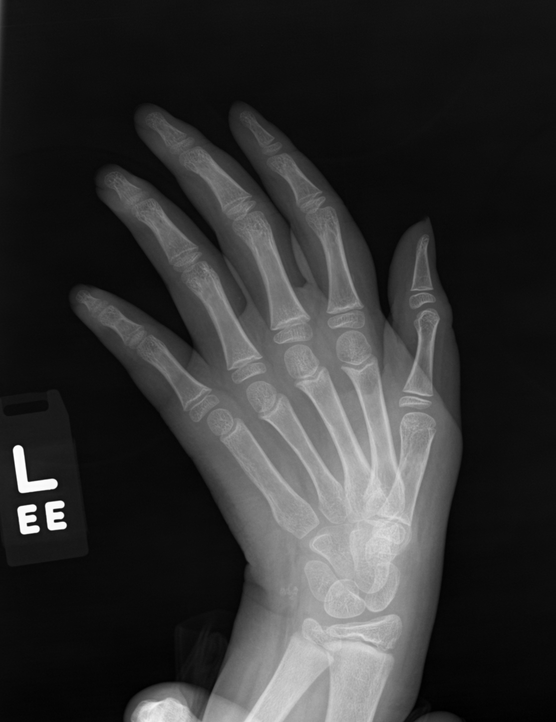 Reference image for male age 12 years 0 months