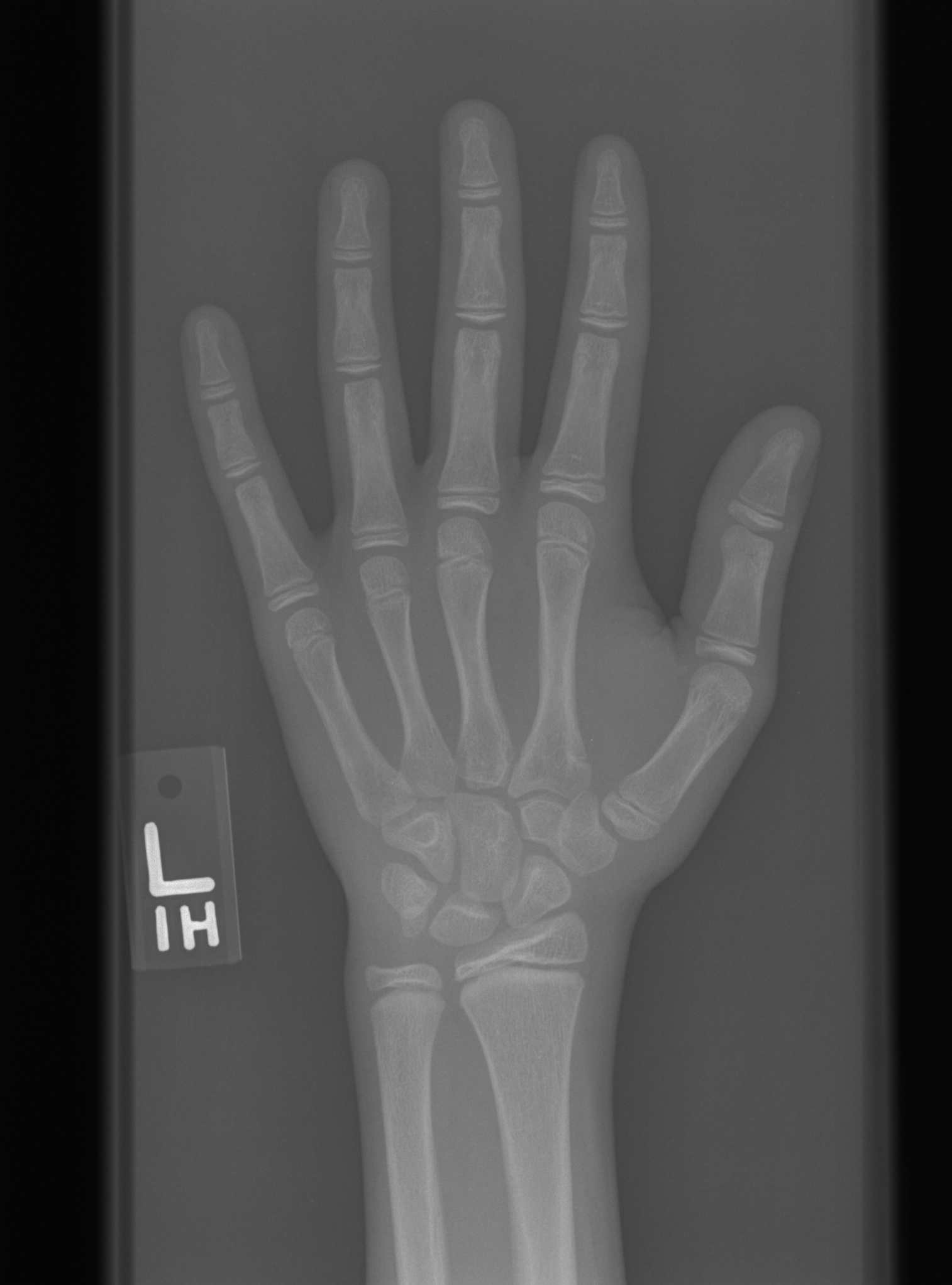 Reference image for male age 13 years 0 months