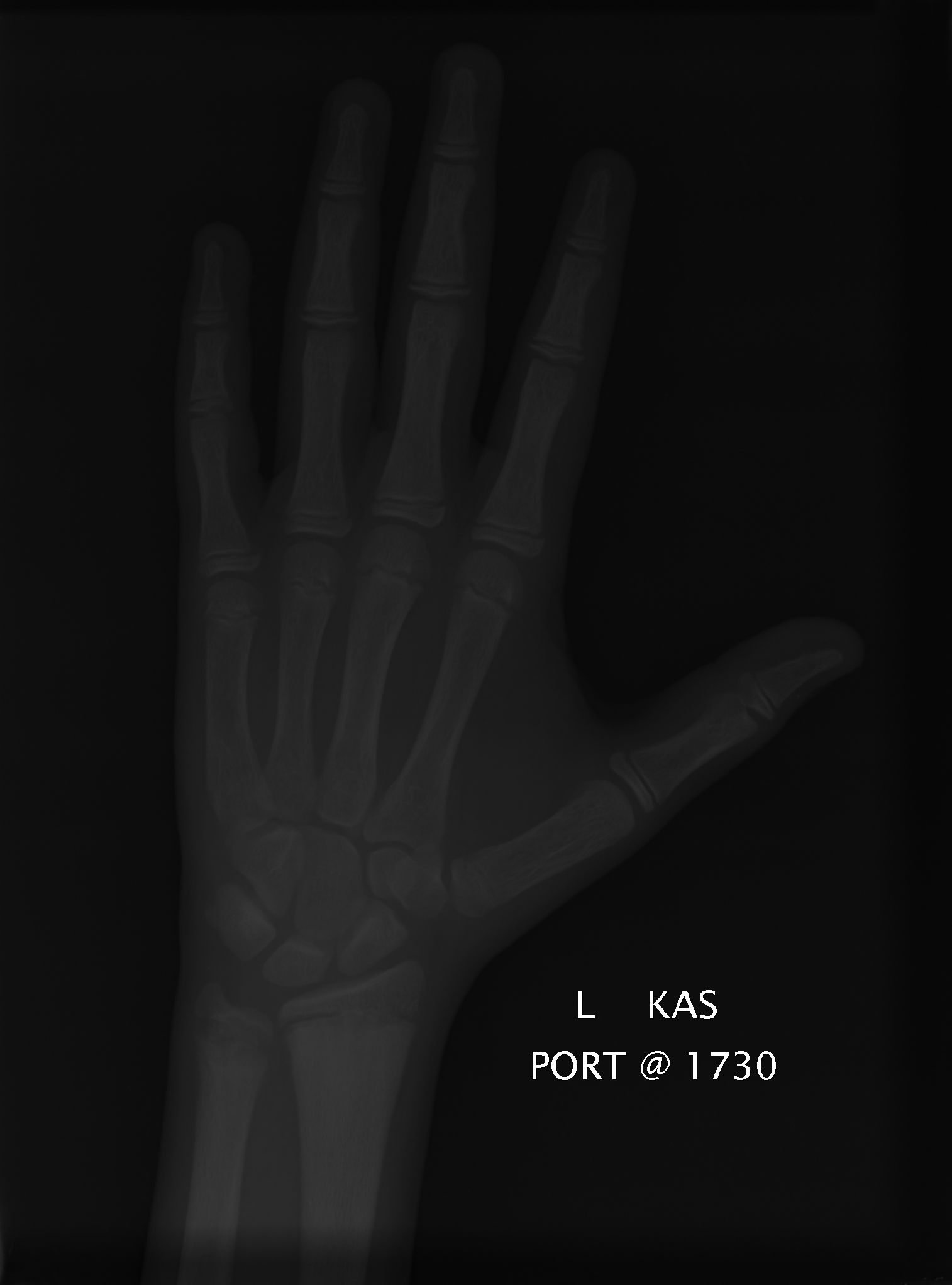 Reference image for male age 14 years 0 months