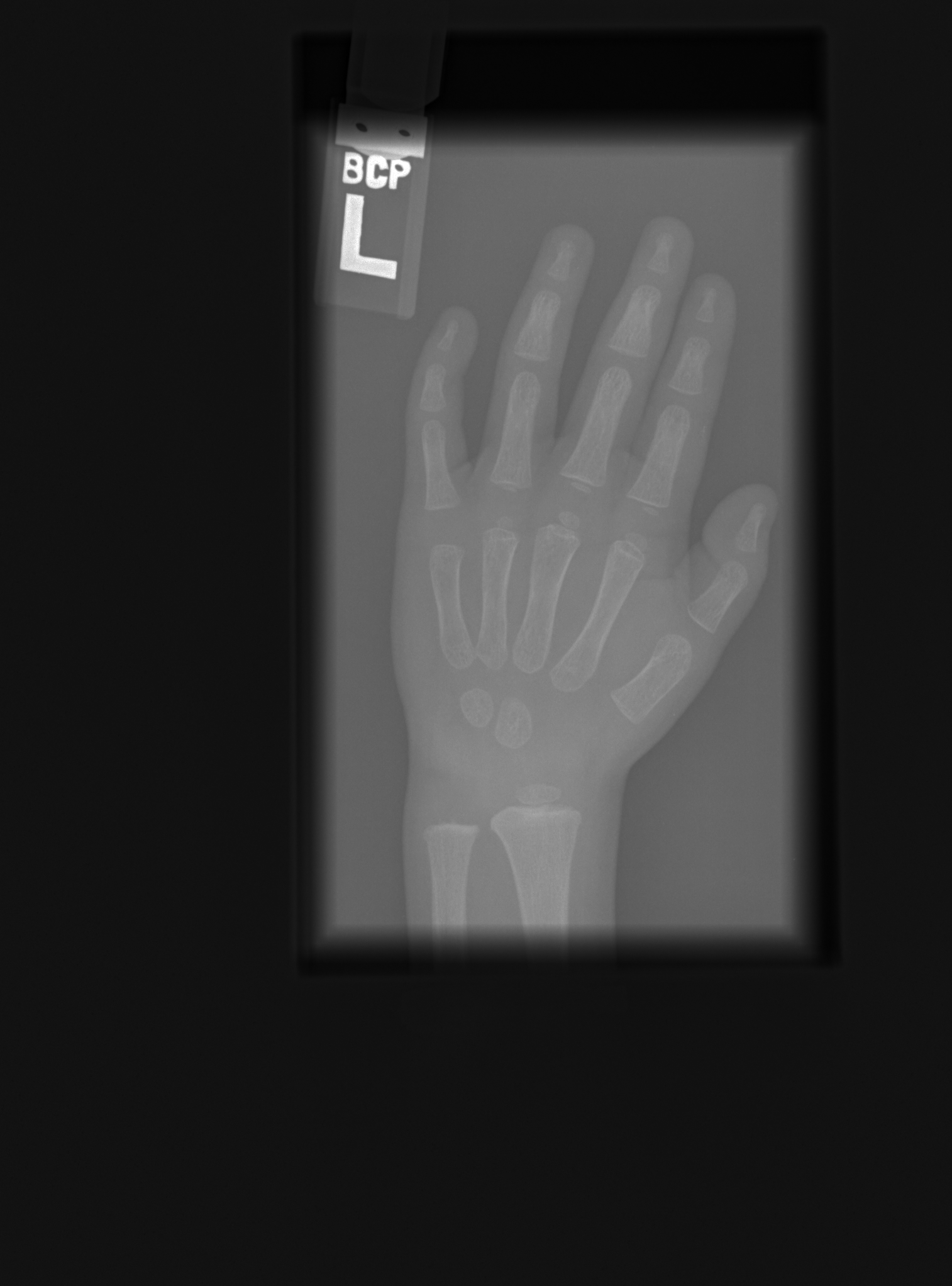 Reference image for male age 1 year 6 months