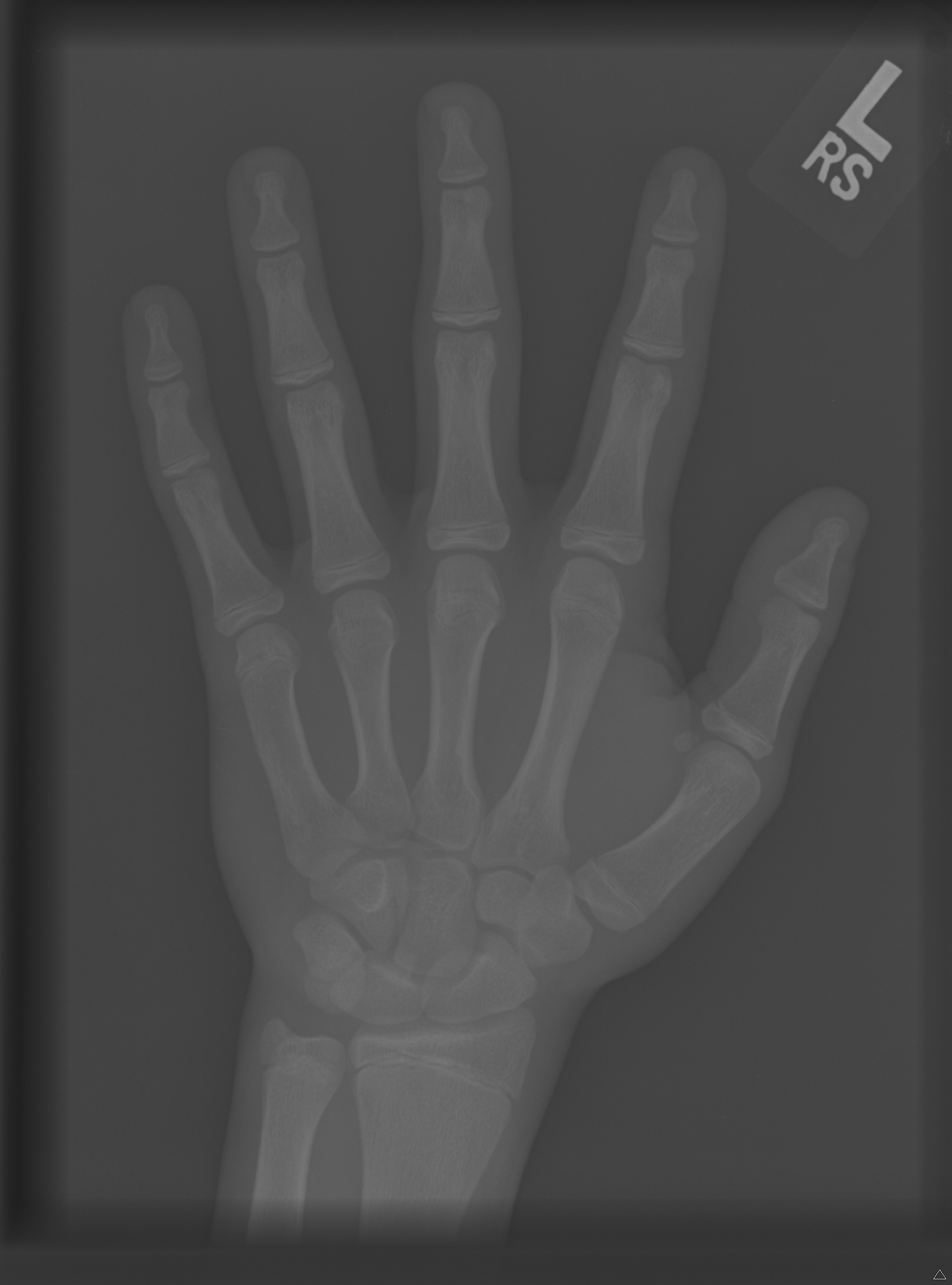 Reference image for male age 15 years 0 months