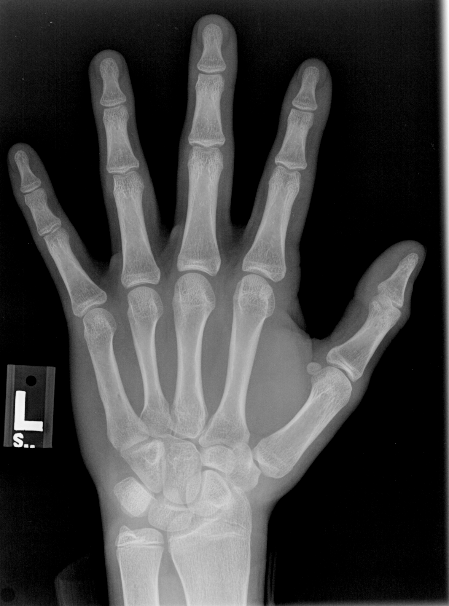 Reference image for male age 16 years 0 months