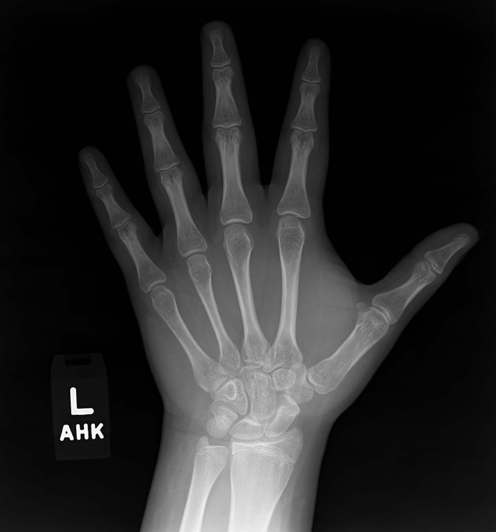 Reference image for male age 17 years 0 months