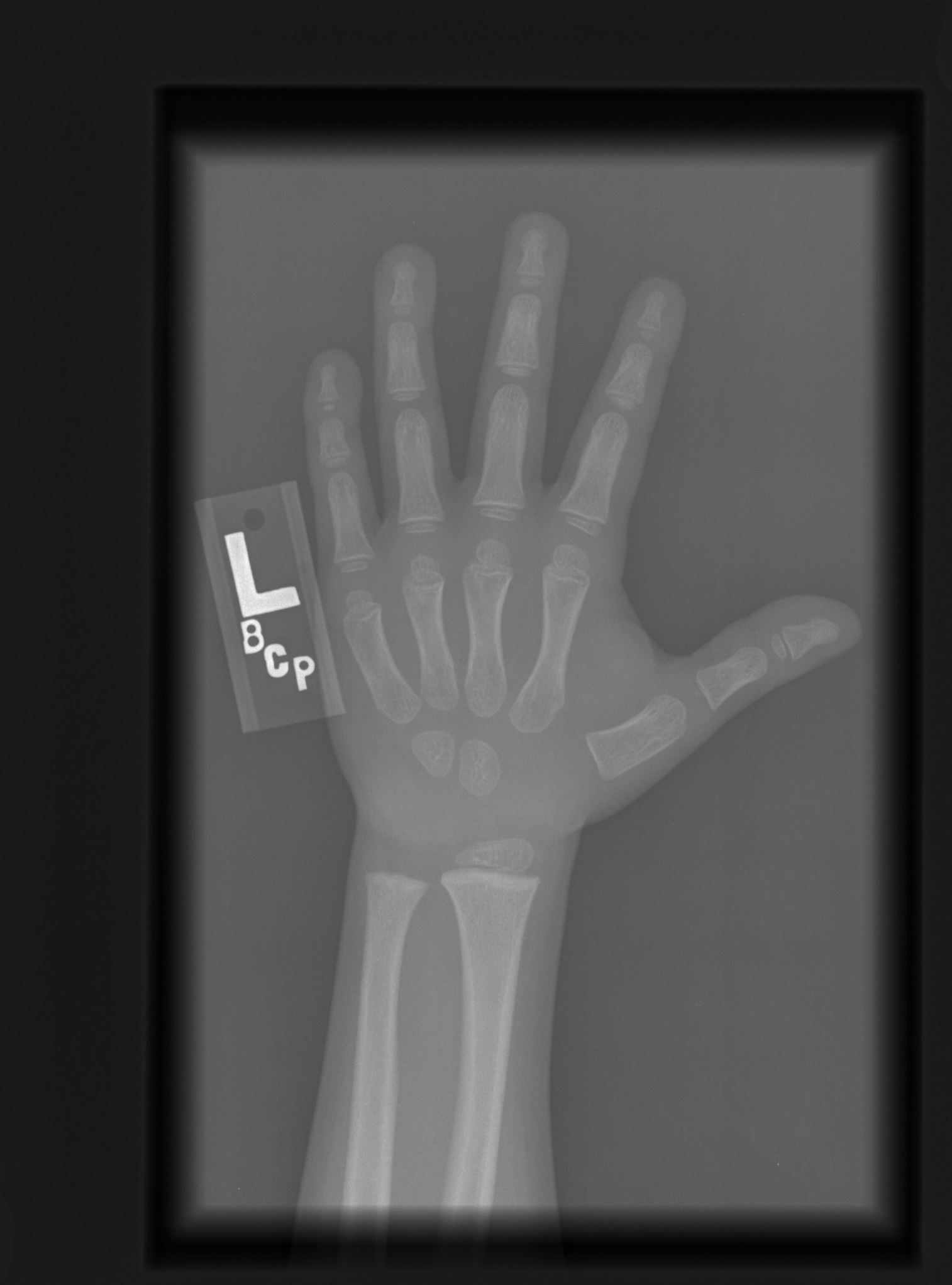 Reference image for male age 2 years 0 months