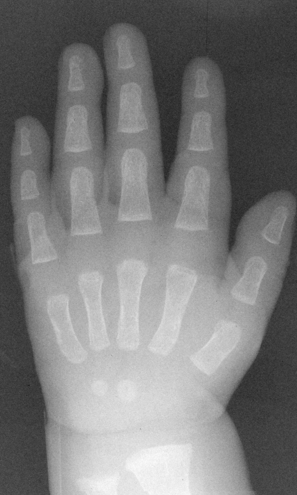 Reference image for male age 0 years 3 months