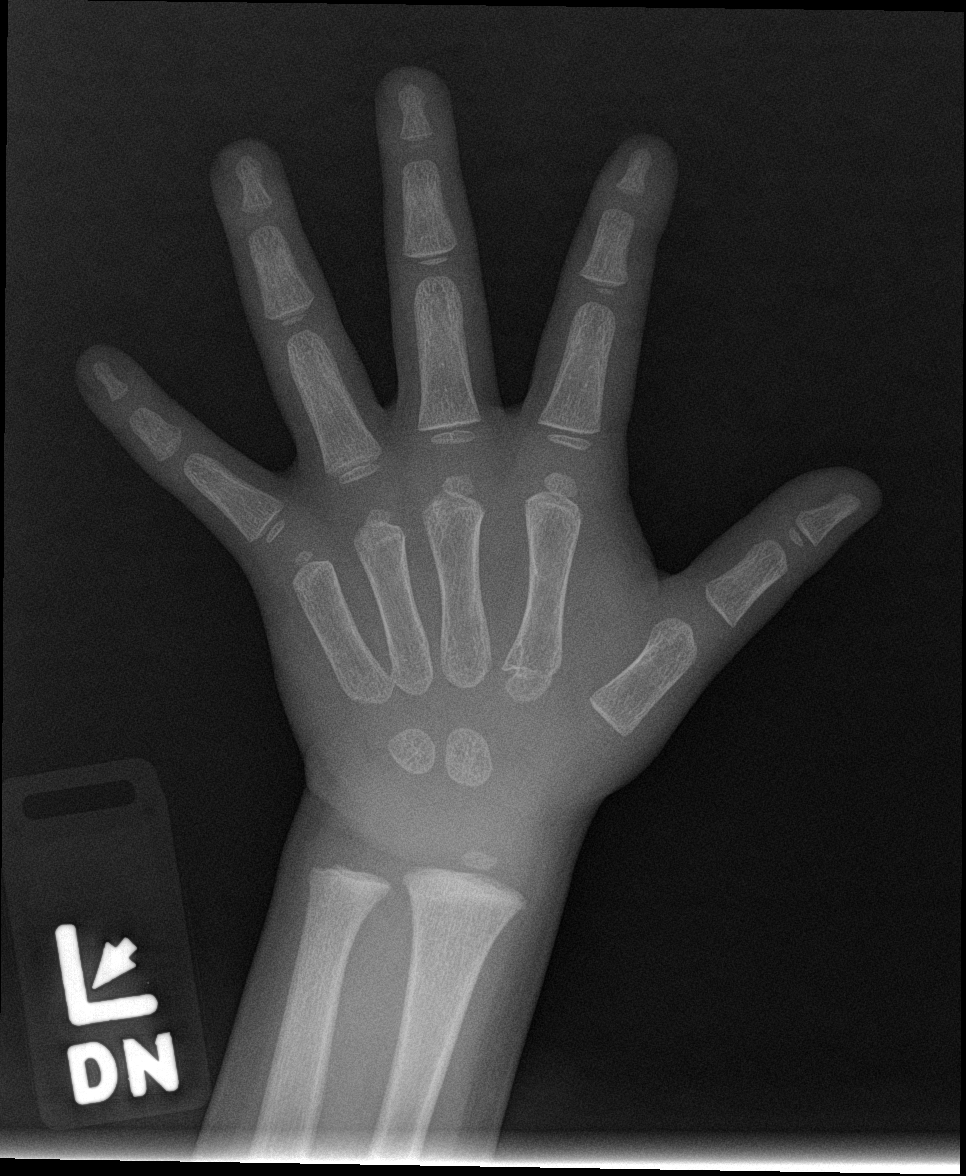 Reference image for male age 2 years 6 months