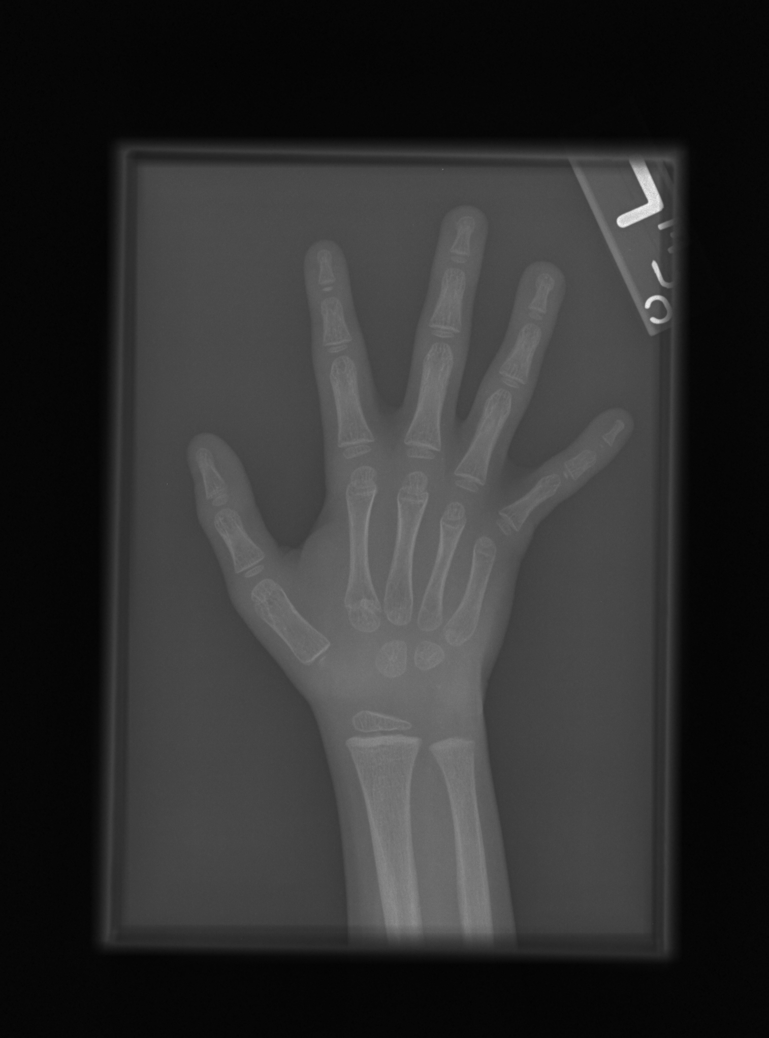 Reference image for male age 3 years 0 months