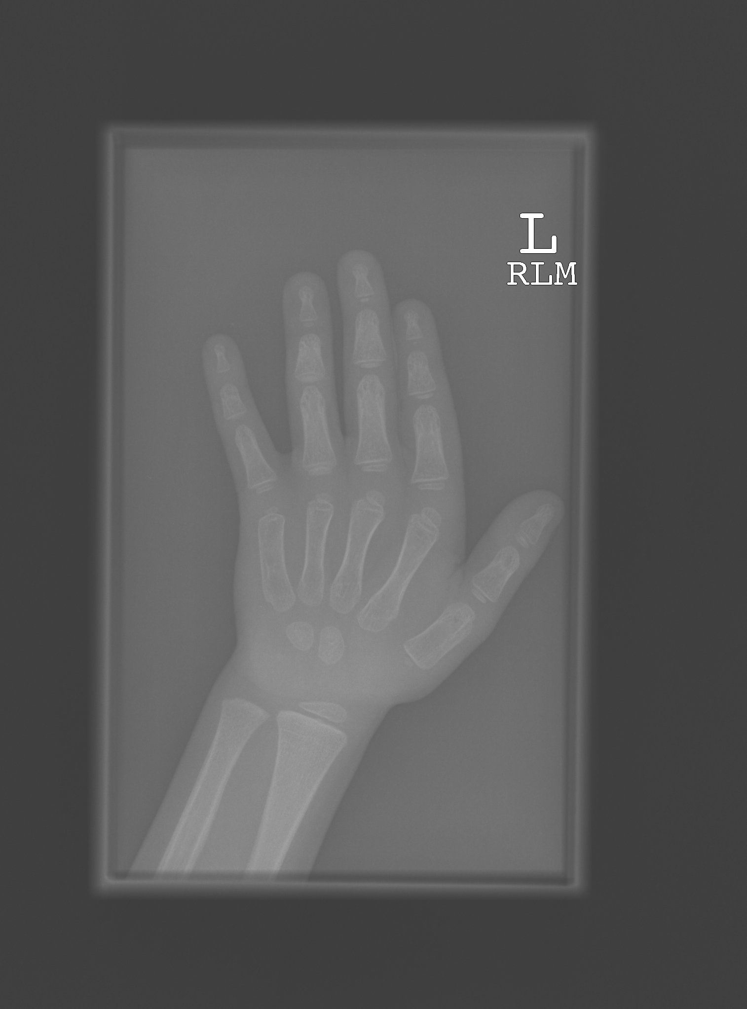 Reference image for male age 3 years 6 months