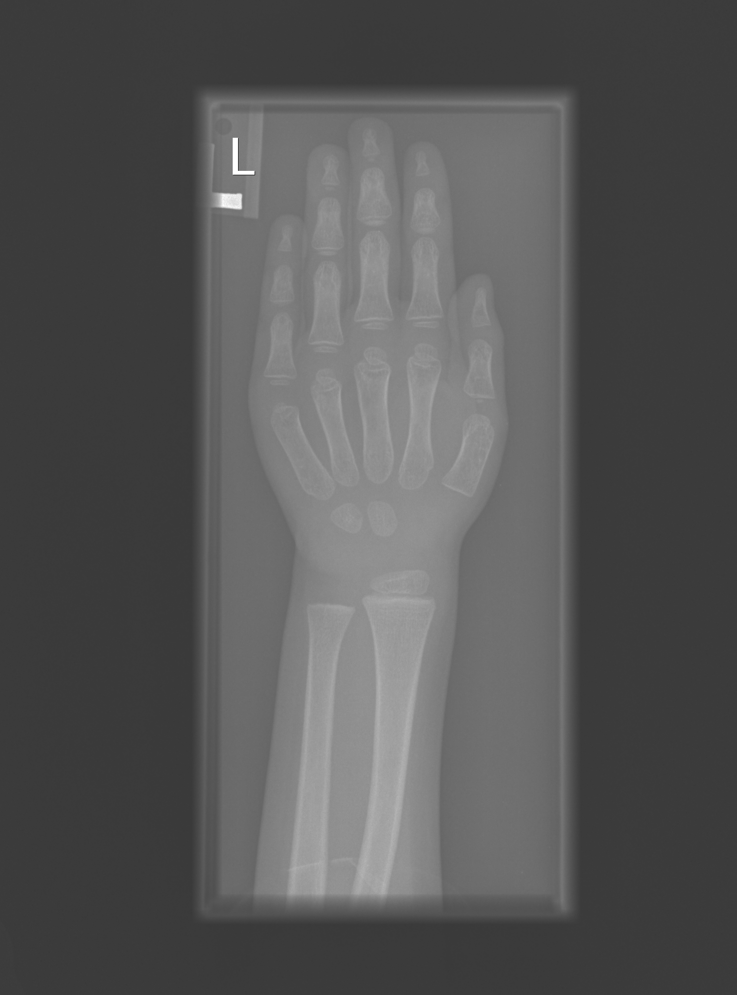 Reference image for male age 4 years 0 months