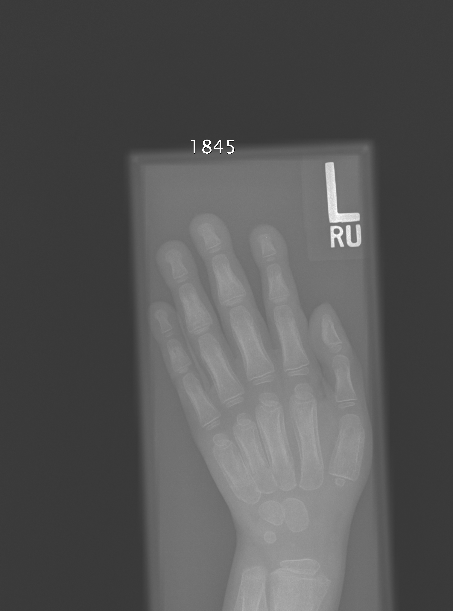 Reference image for male age 4 years 6 months