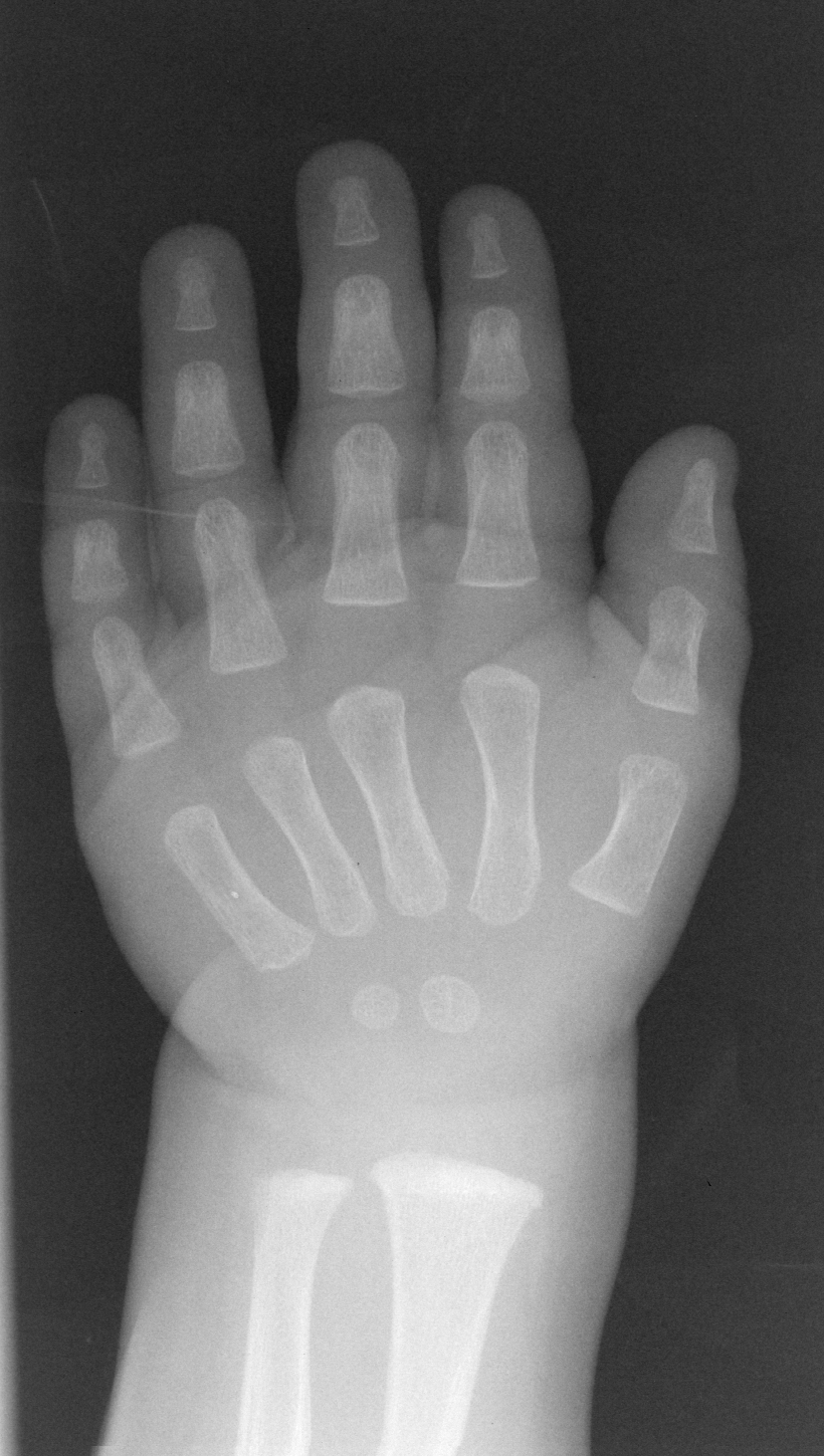 Reference image for male age 0 years 6 months