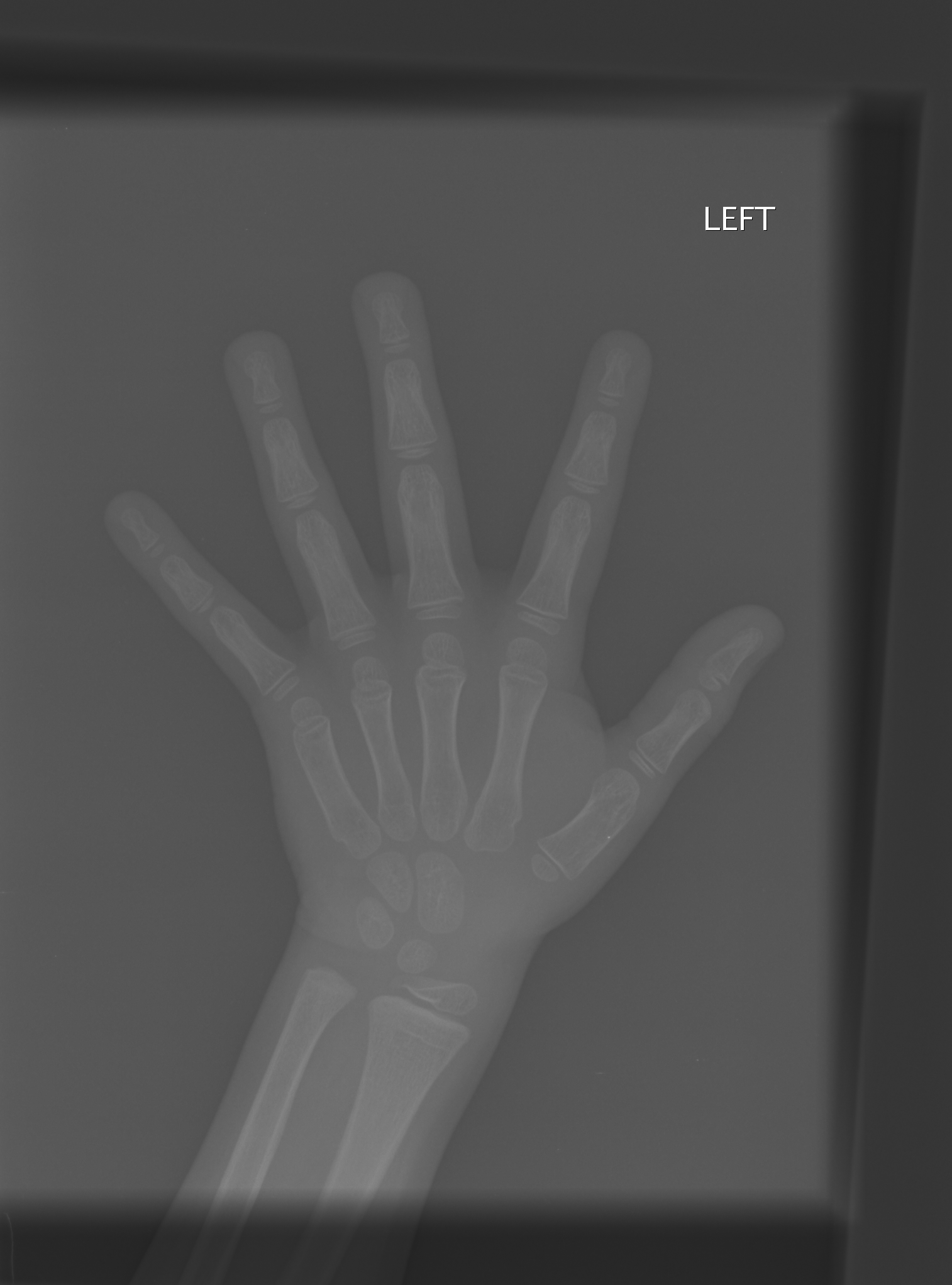 Reference image for male age 5 years 0 months