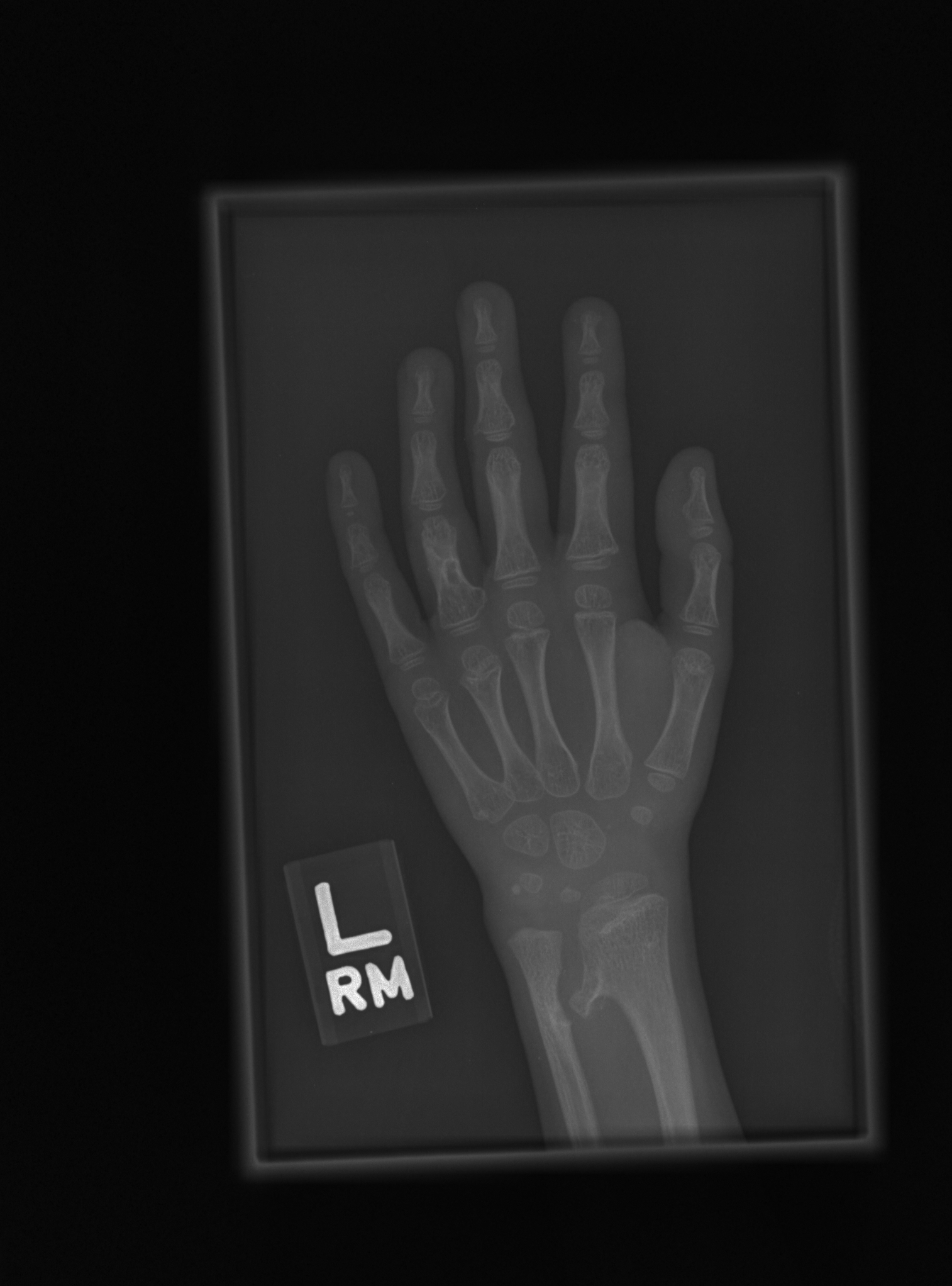 Reference image for male age 6 years 0 months