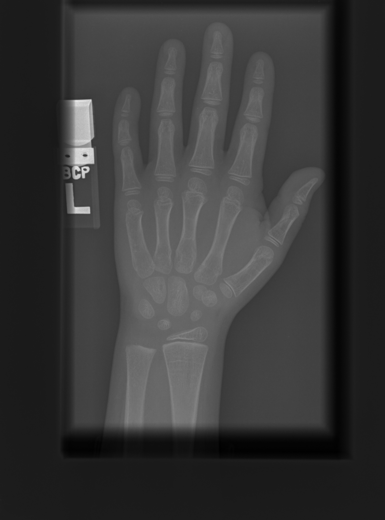 Reference image for male age 7 years 0 months