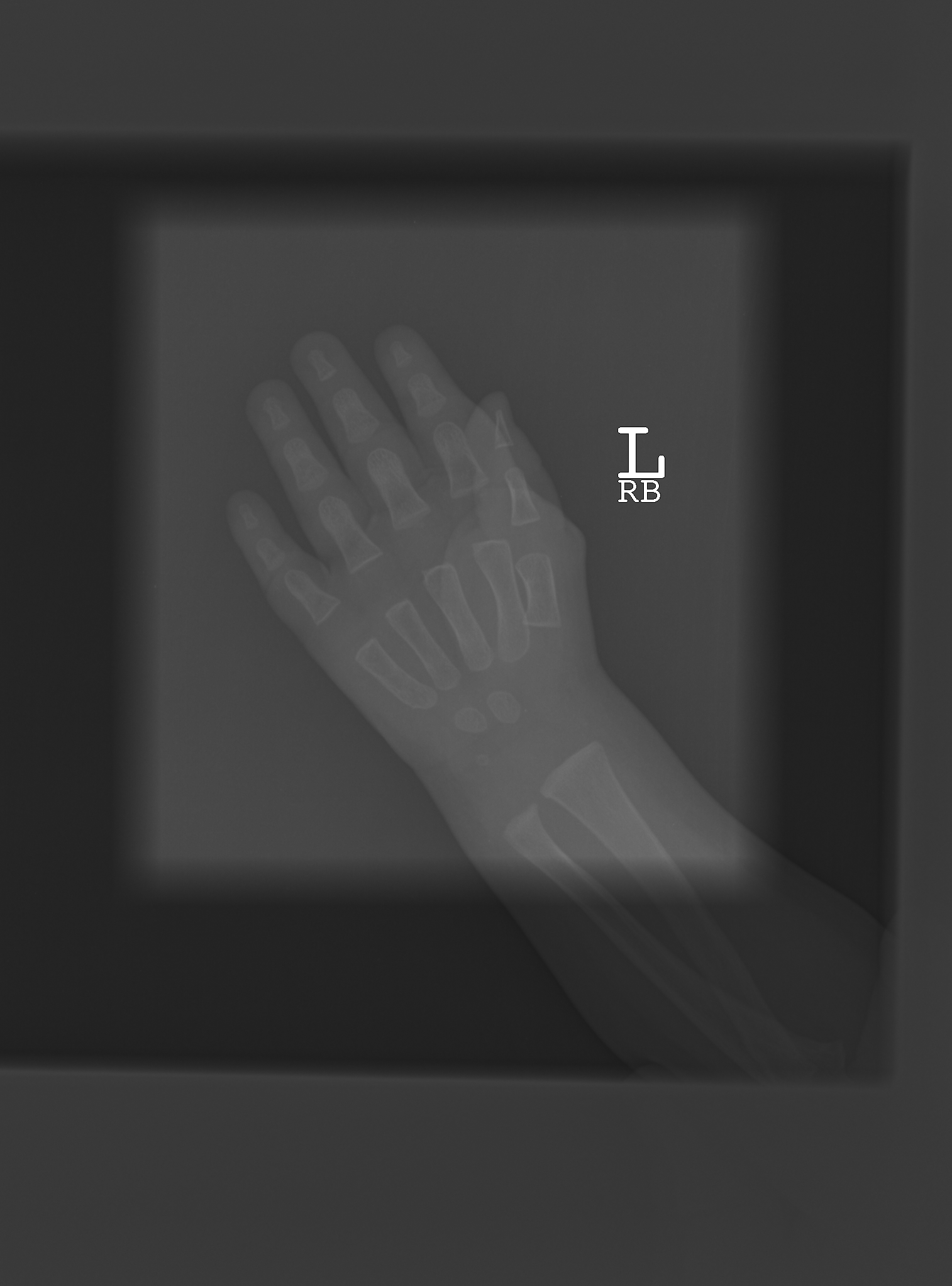 Reference image for male age 0 years 9 months