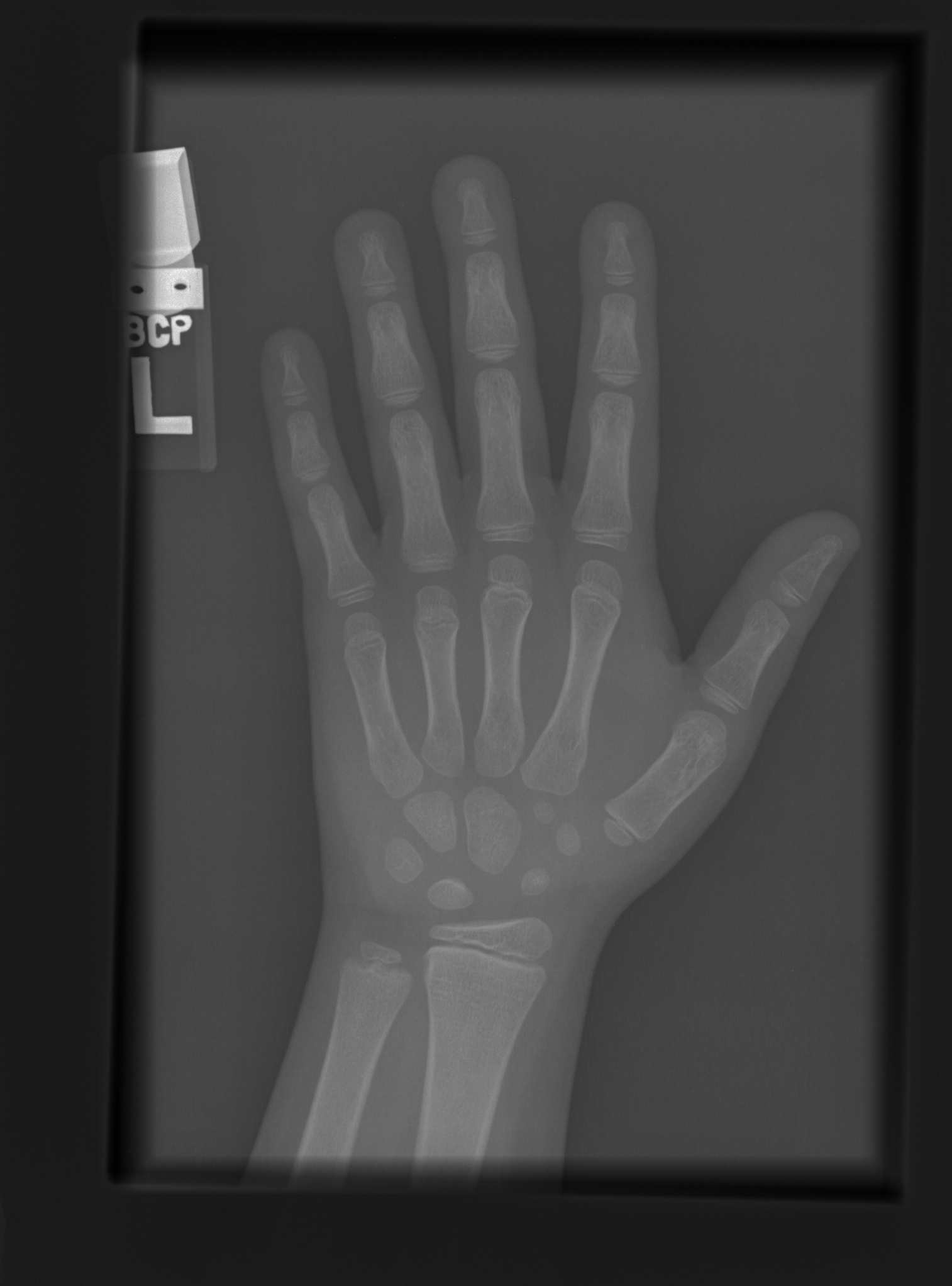 Reference image for male age 8 years 0 months